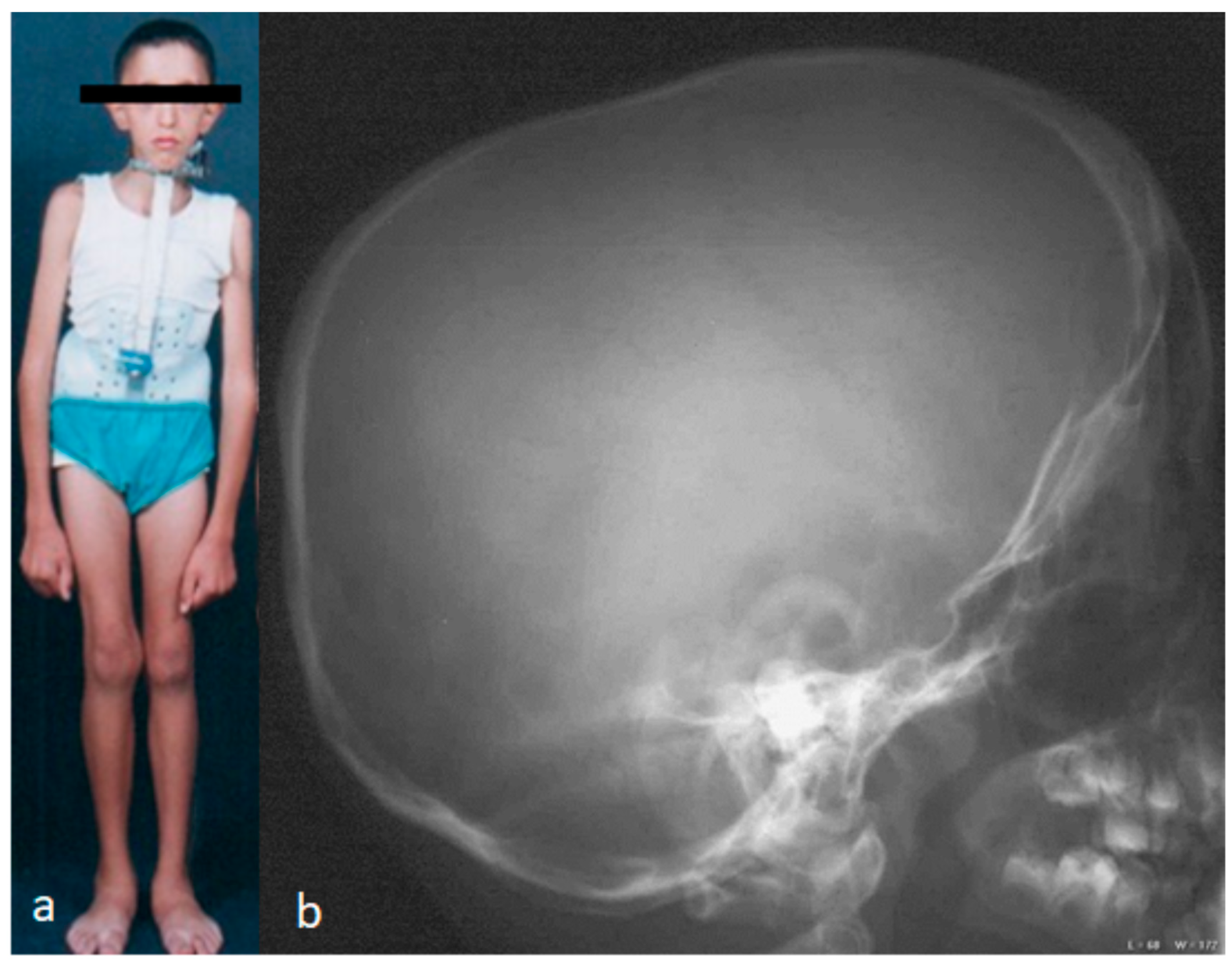 Children 10 01240 g001