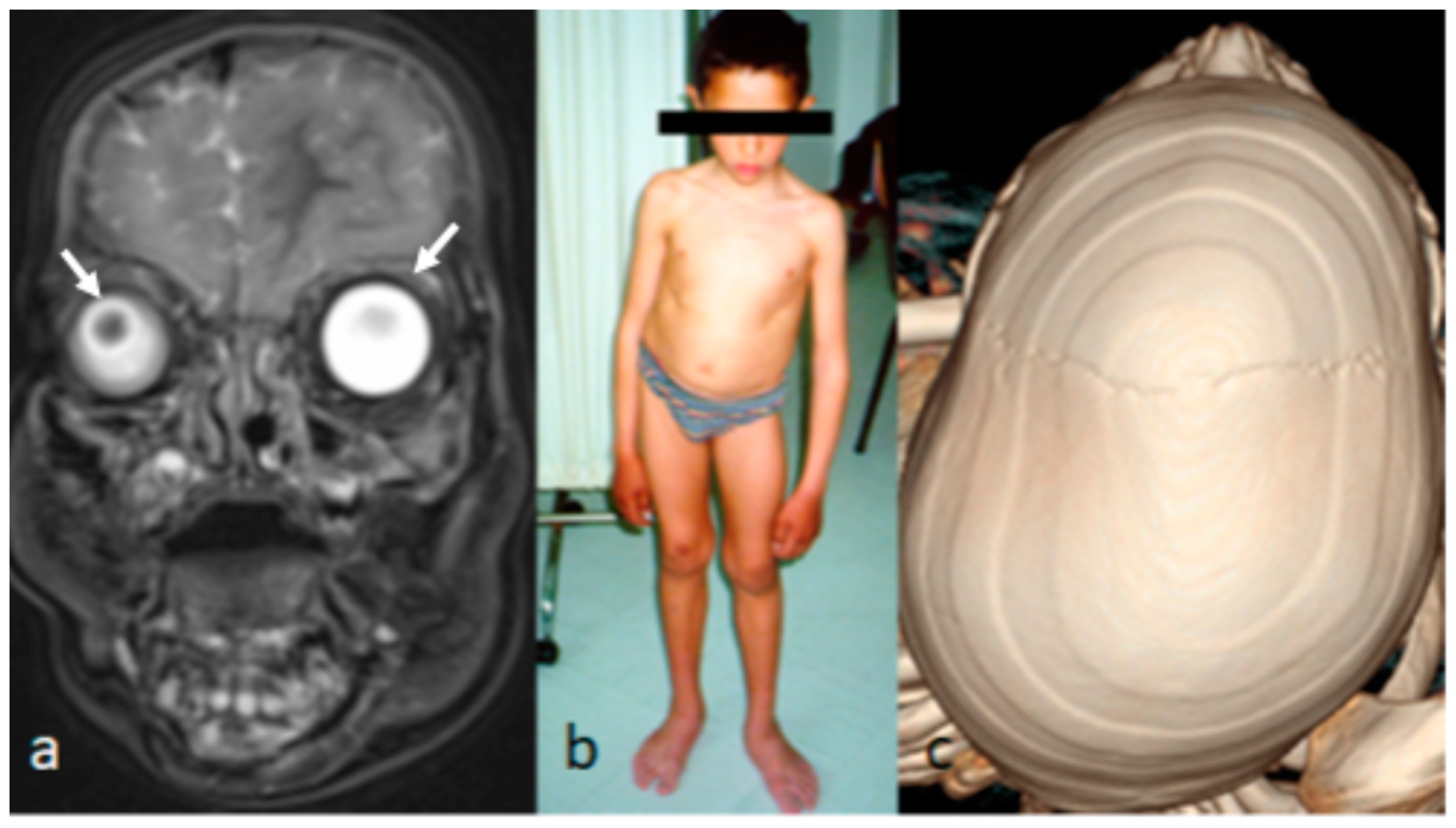 Children 10 01240 g002