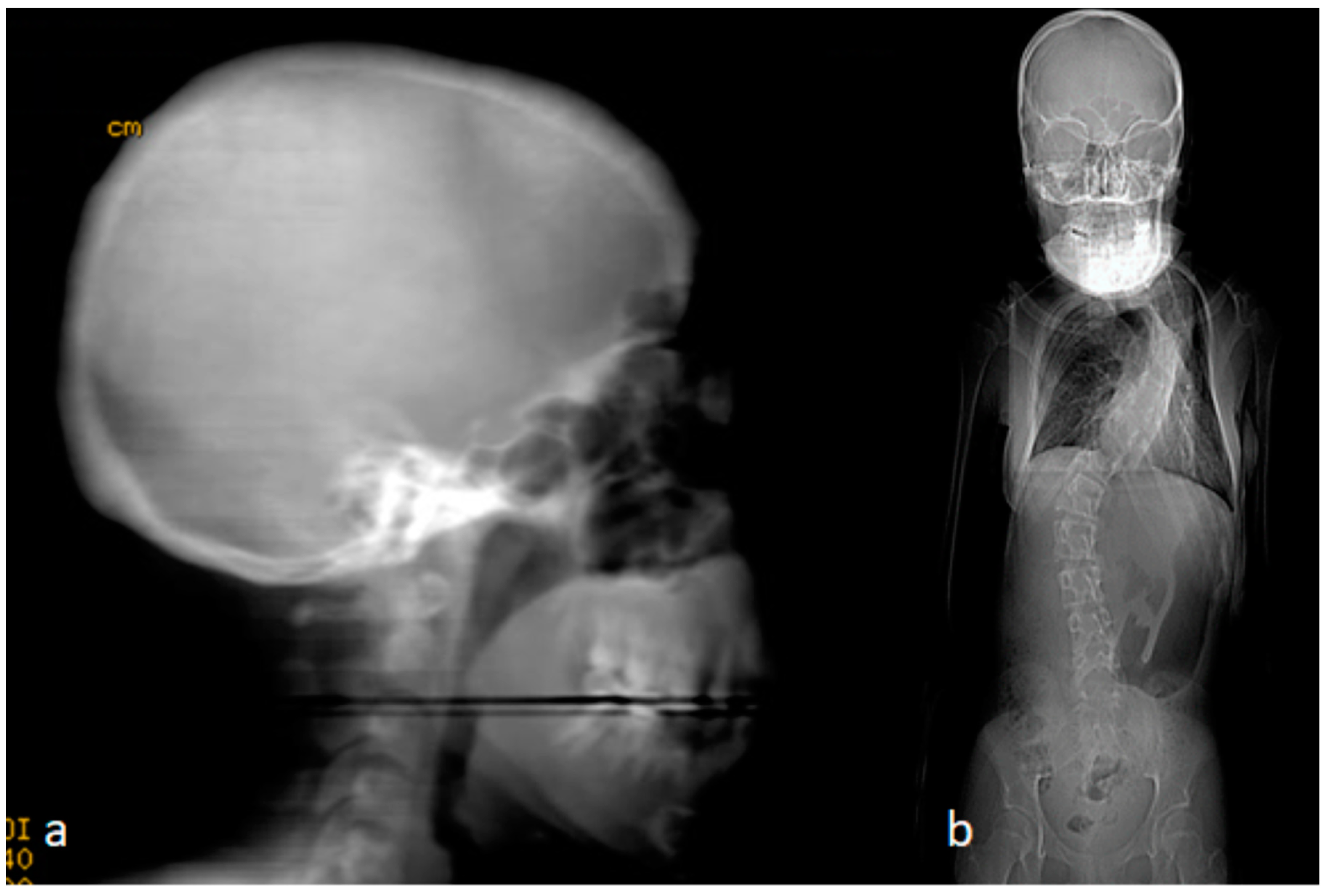 Children 10 01240 g003