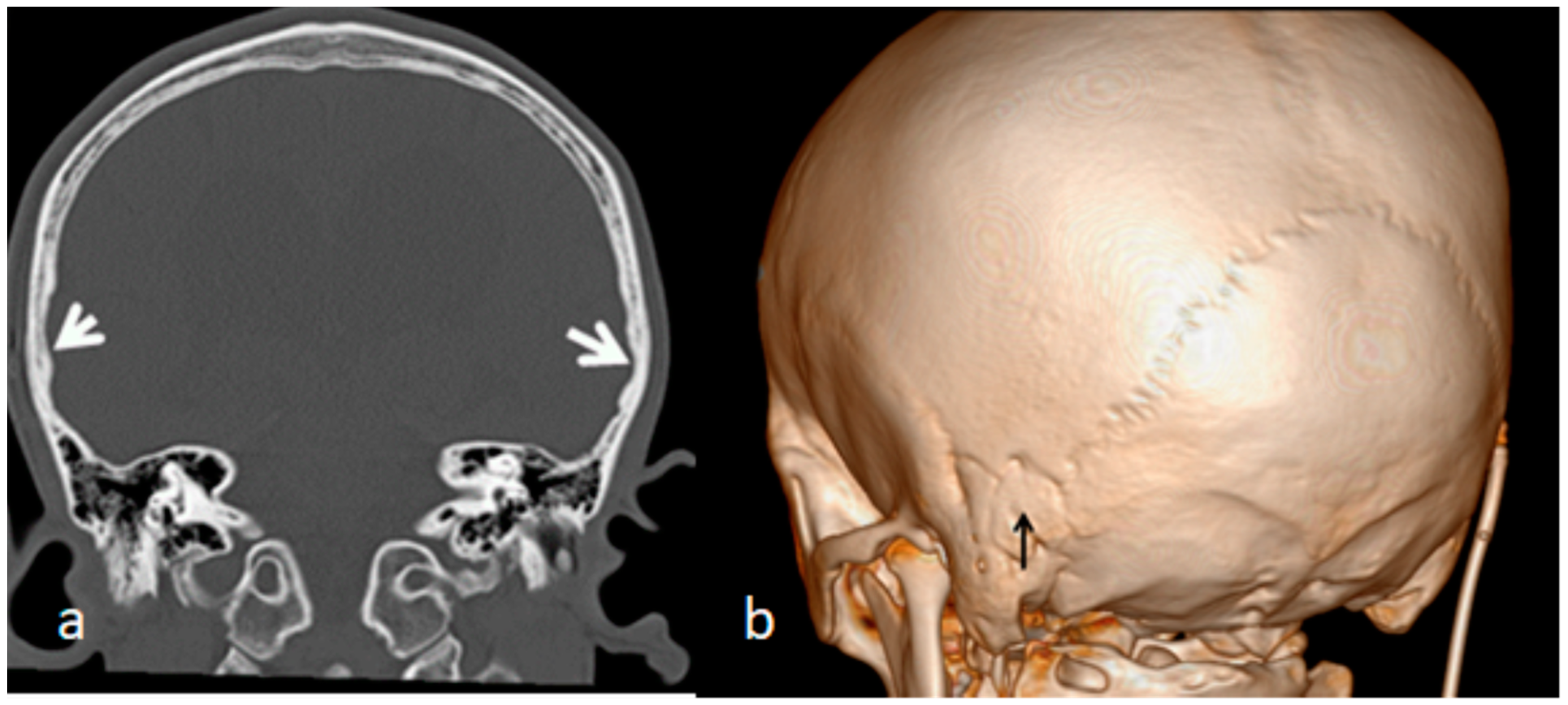 Children 10 01240 g005