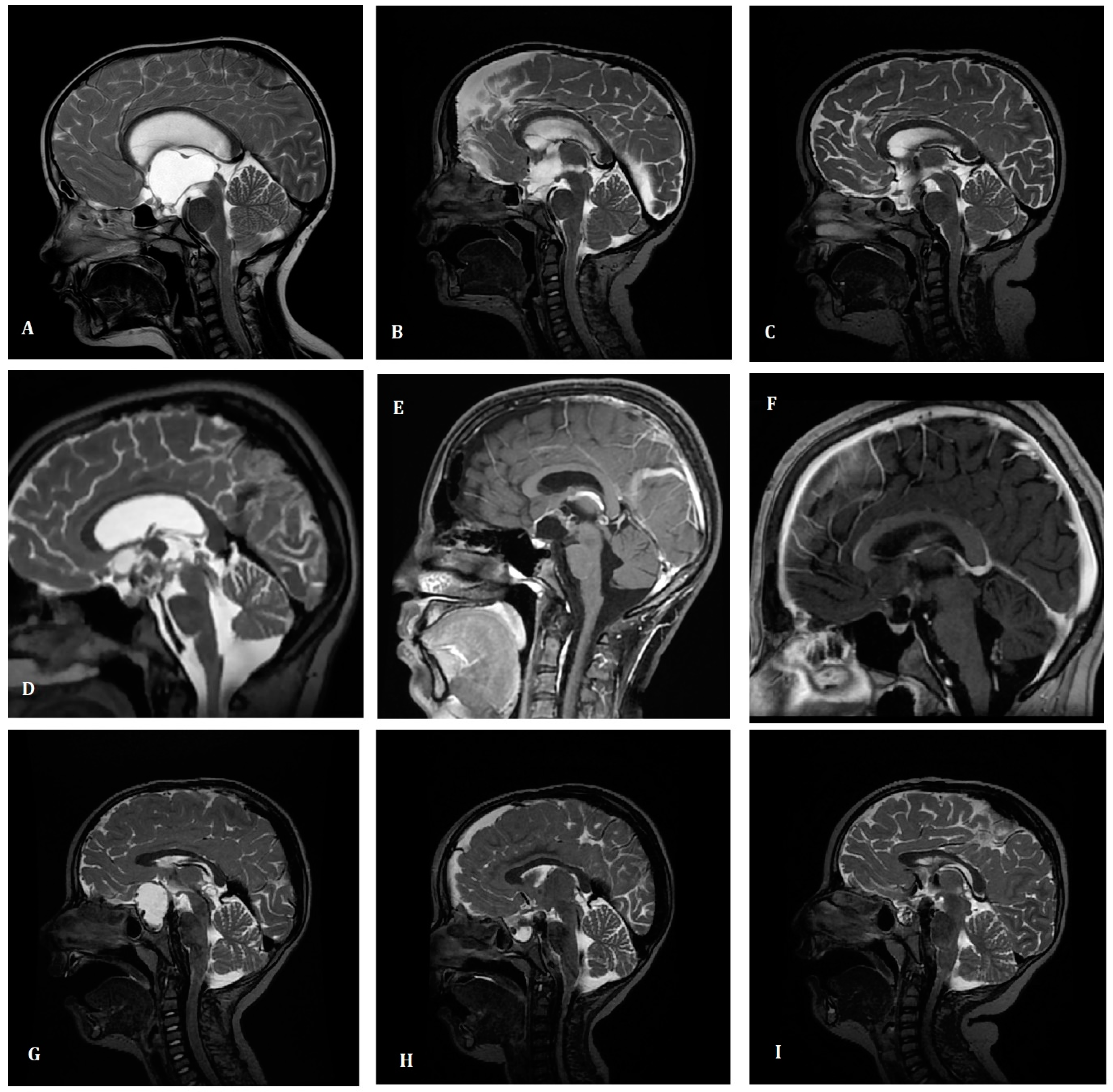 Children 10 01272 g001 Children 10 01272 g001