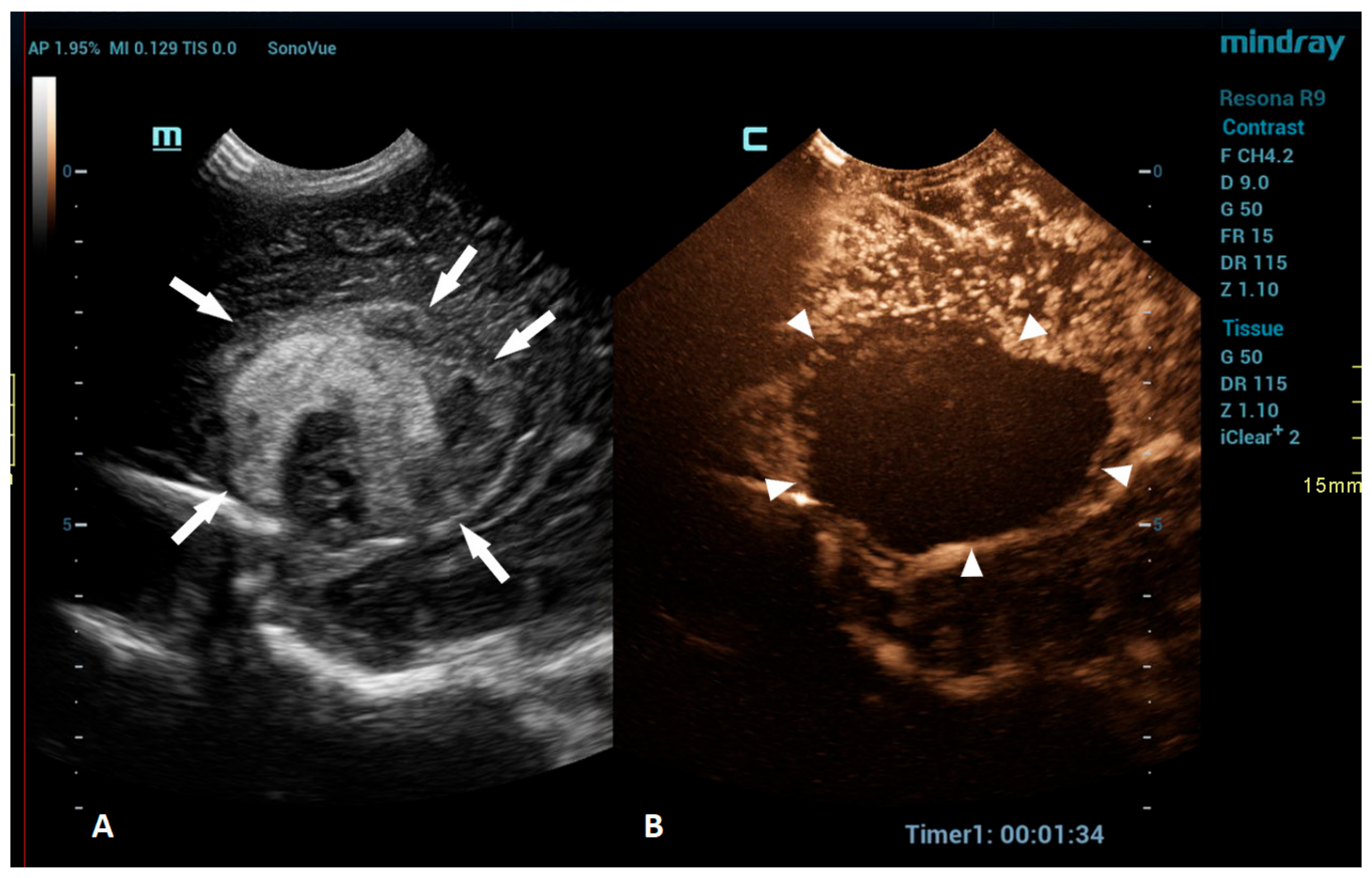 Children 10 01303 g003 Children 10 01303 g003