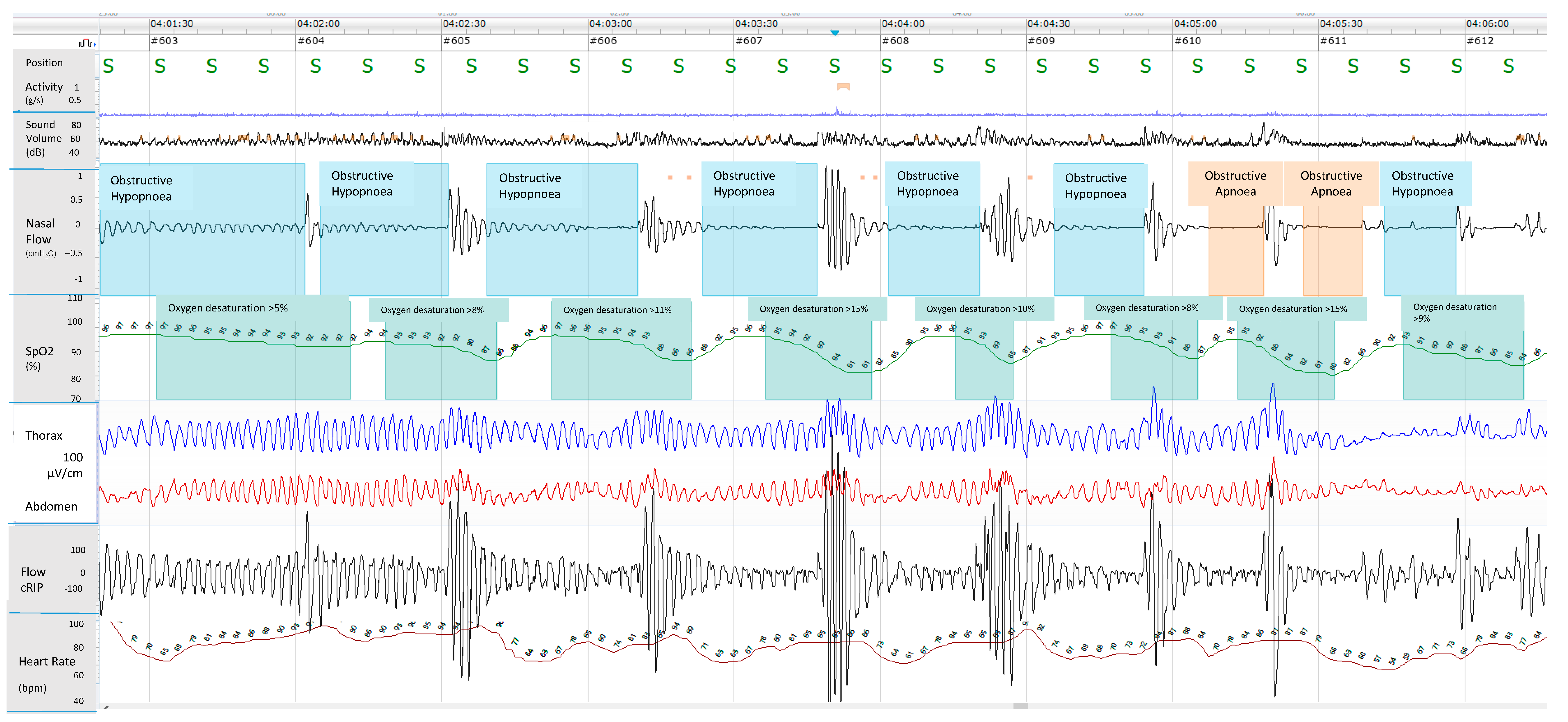Children 10 01331 g003 Children 10 01331 g003