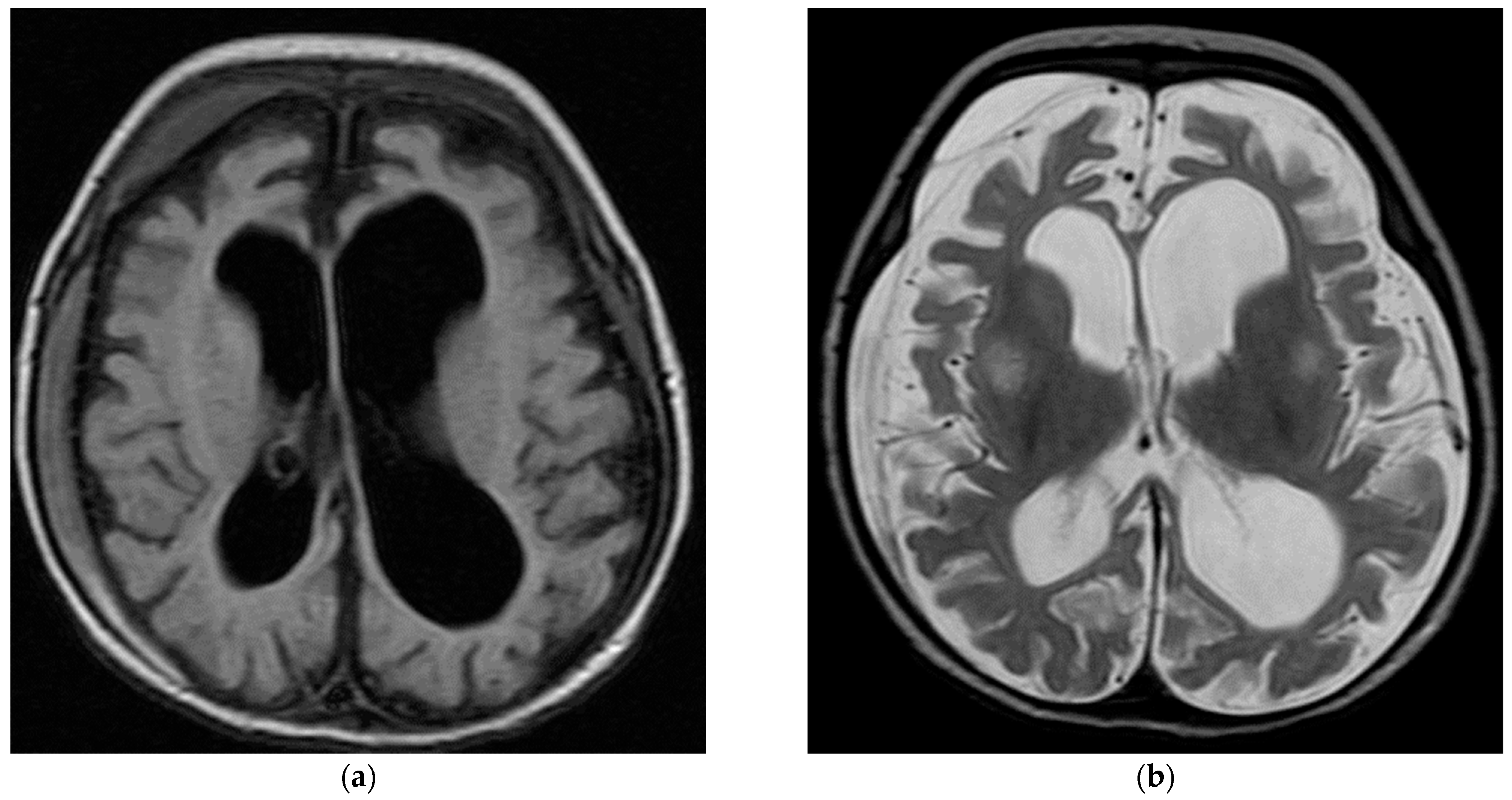 Children 10 01334 g001 Children 10 01334 g001