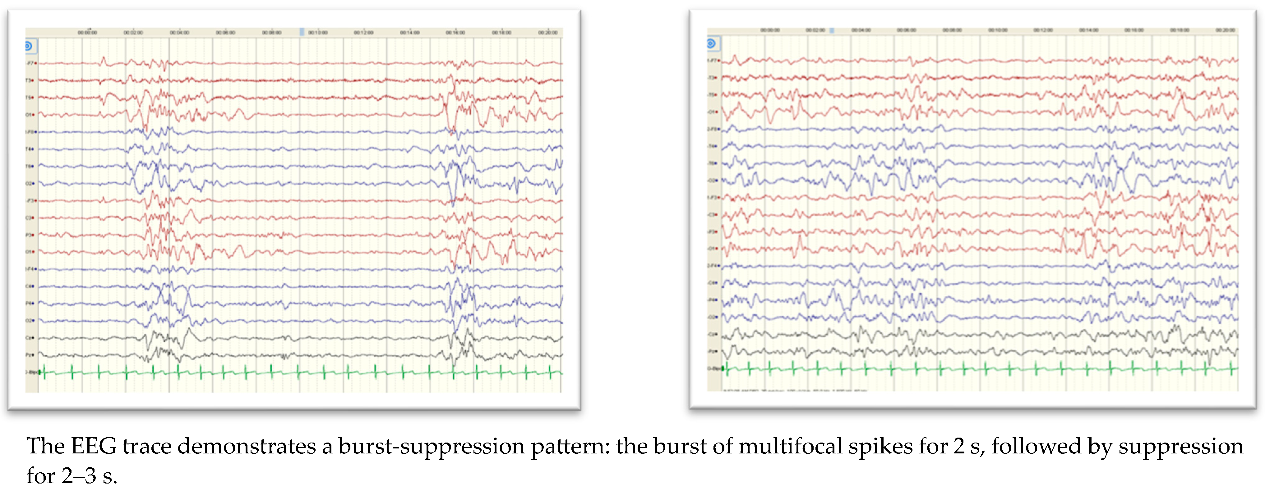 Children 10 01334 g002 Children 10 01334 g002