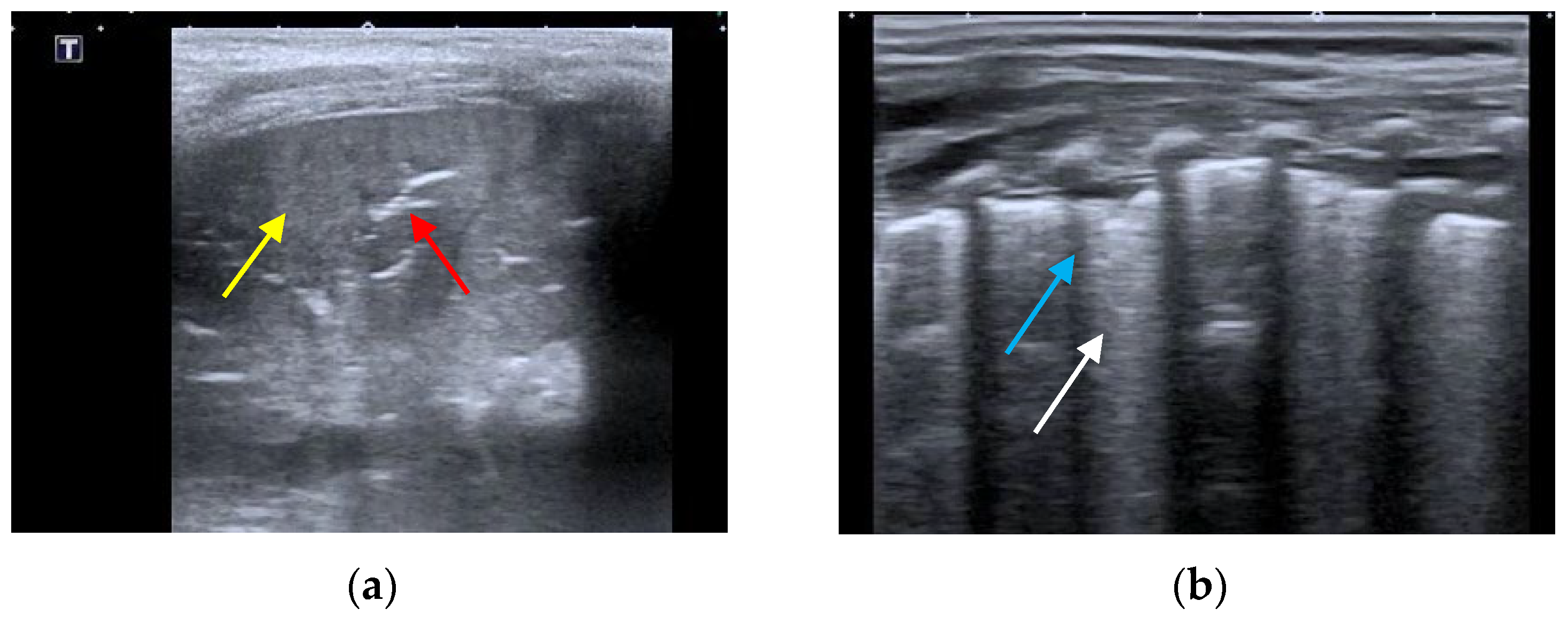 Children 10 01335 g002 Children 10 01335 g002