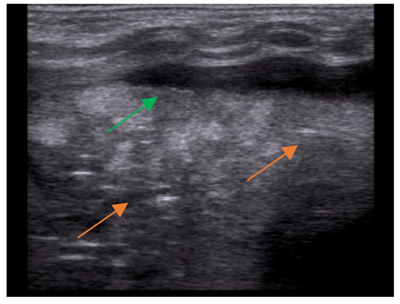 Children 10 01335 g003 Children 10 01335 g003