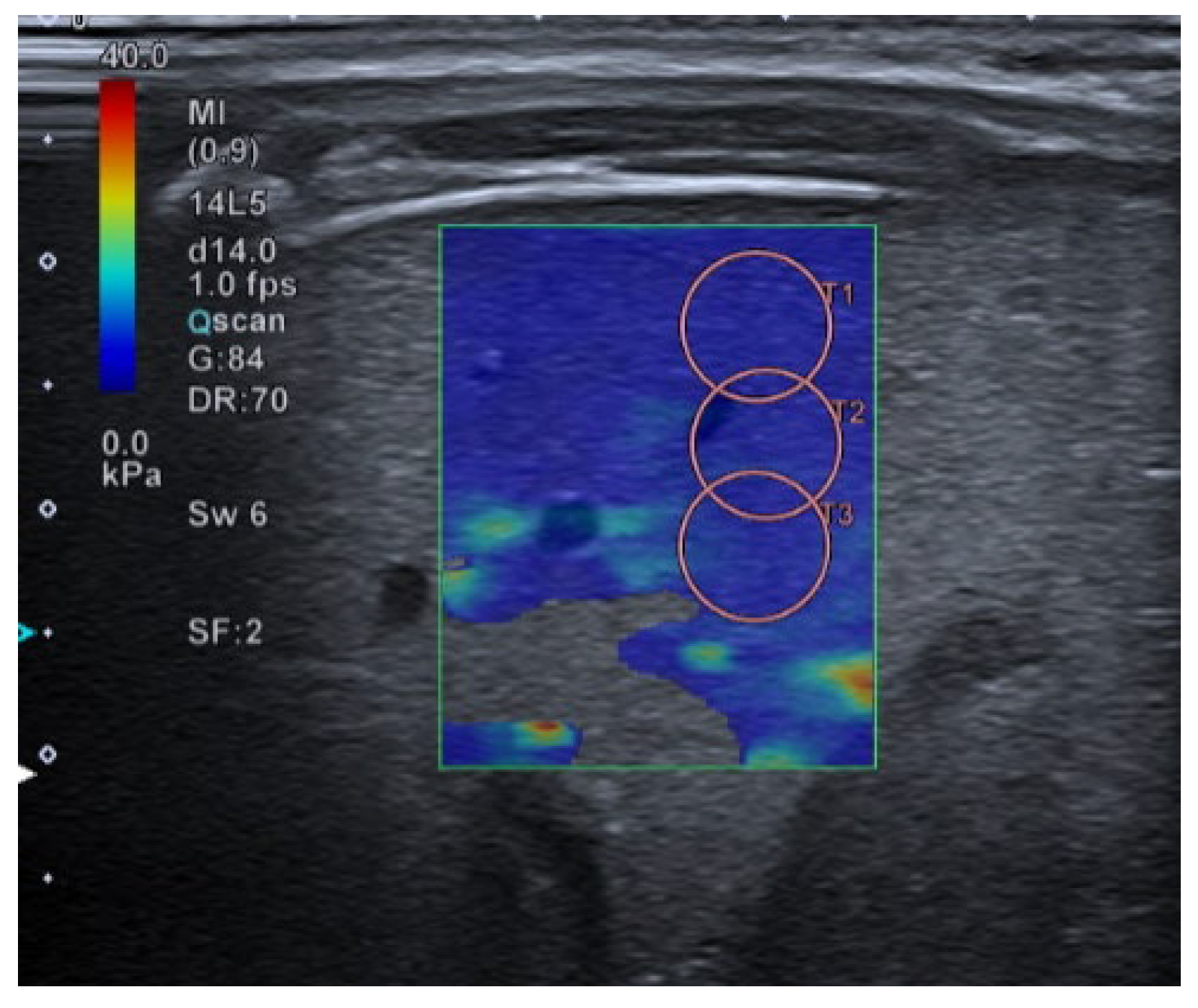 Children 10 01335 g005 Children 10 01335 g005