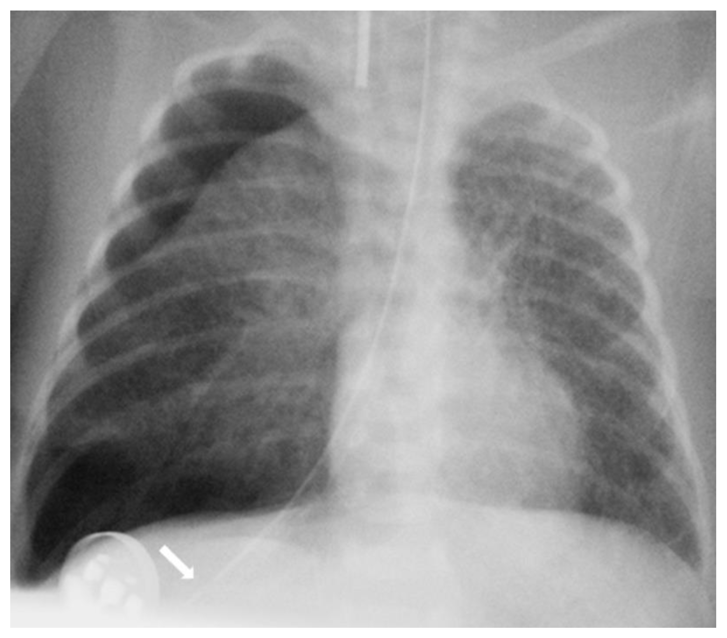 Children 10 01399 g001