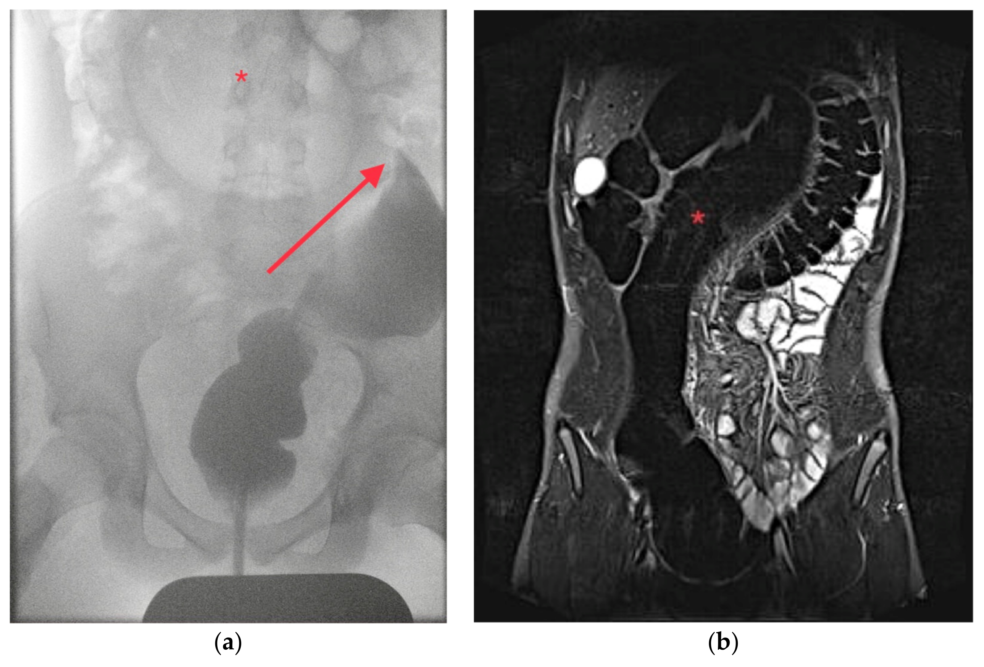Children 10 01441 g002
