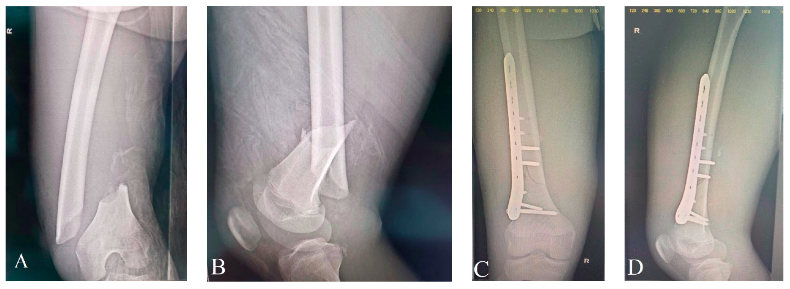 Children 10 01446 g003 Children 10 01446 g003