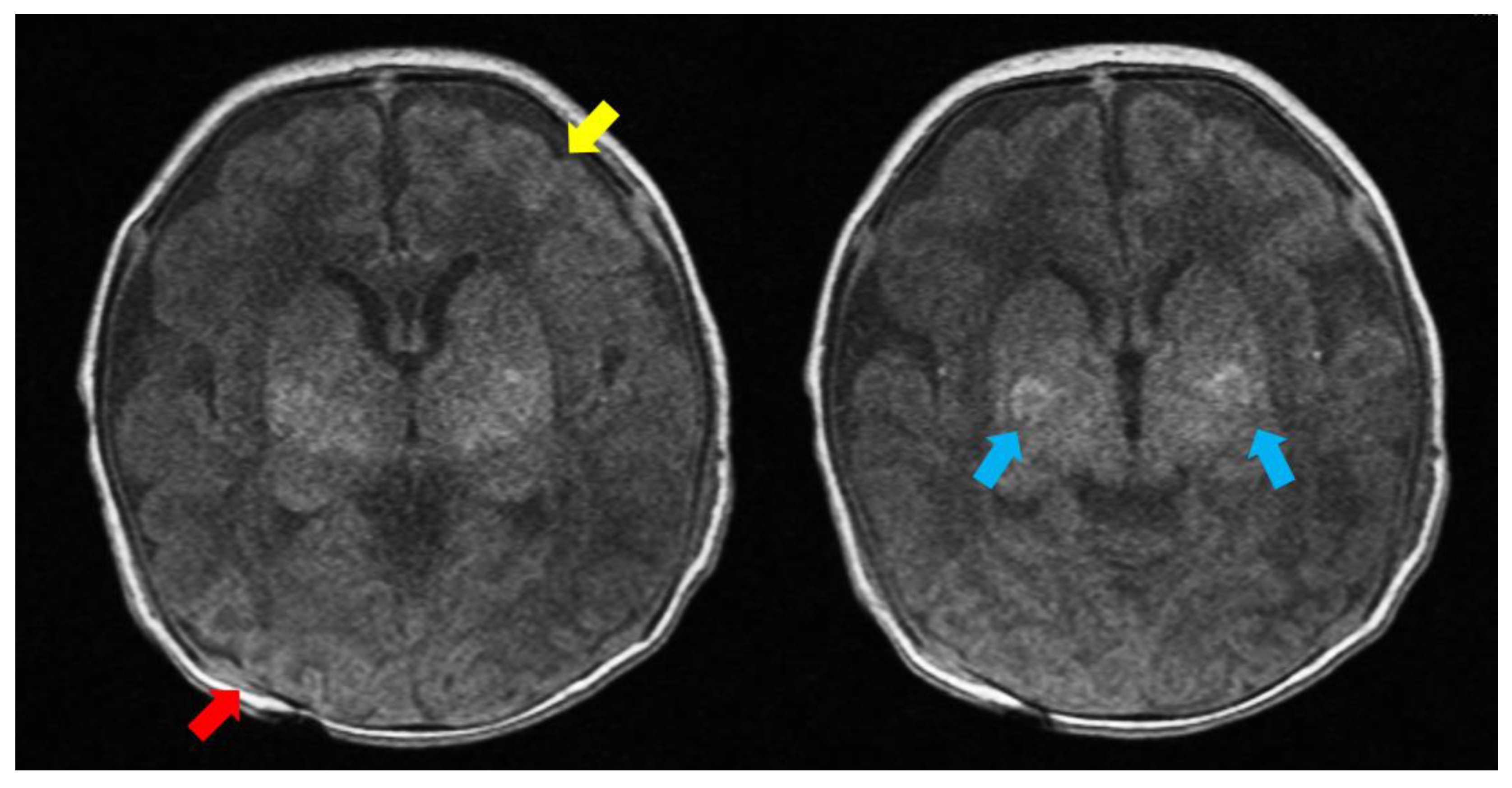 Children 10 01461 g001