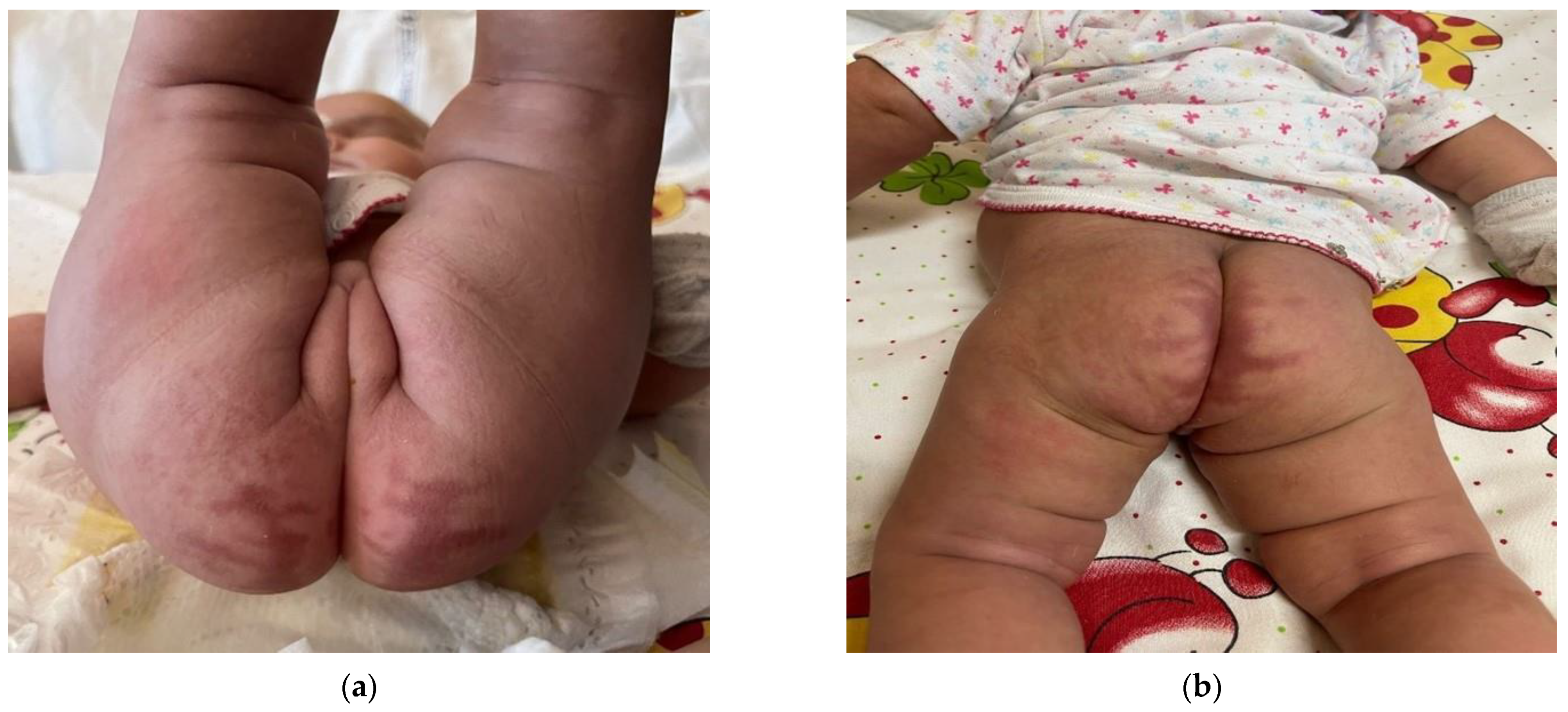 Children 10 01491 g004