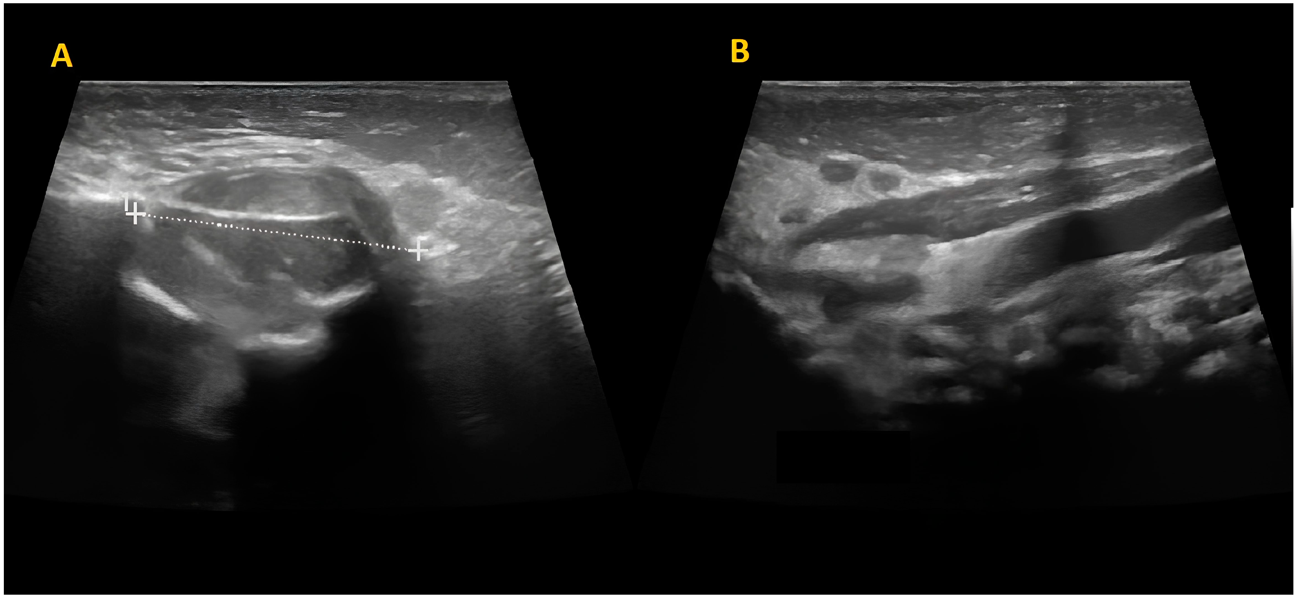 Children 10 01818 g002