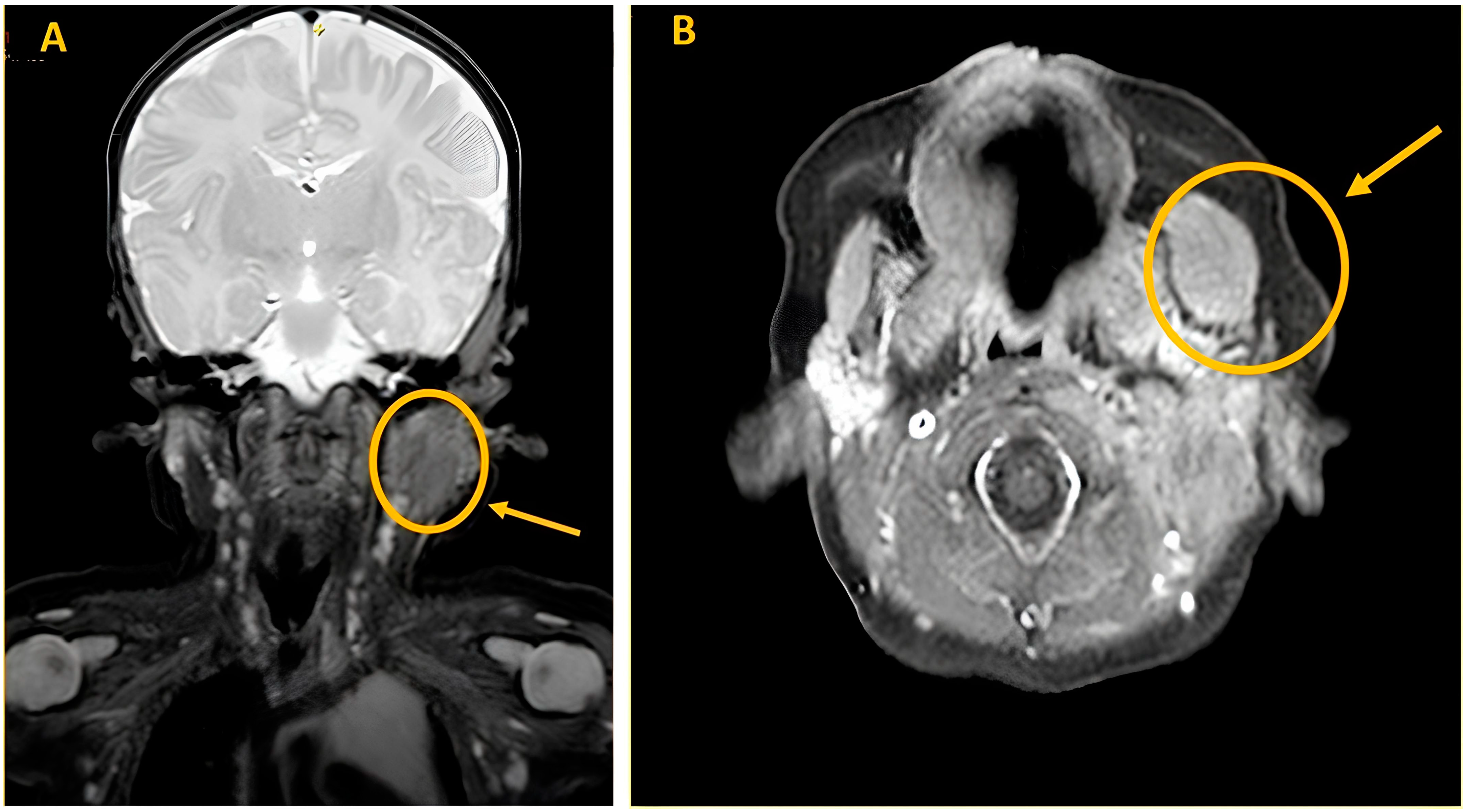 Children 10 01818 g003