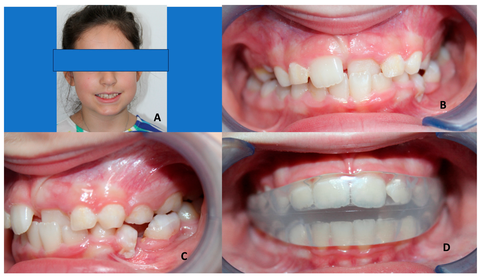 Children 10 01821 g006