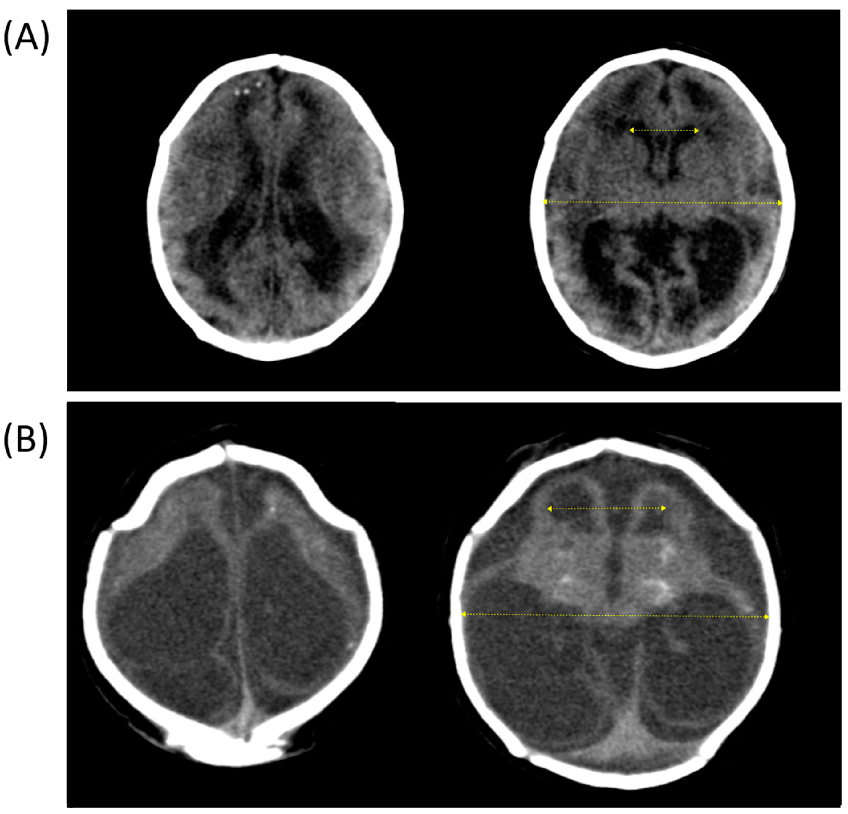 Children 10 01831 g002