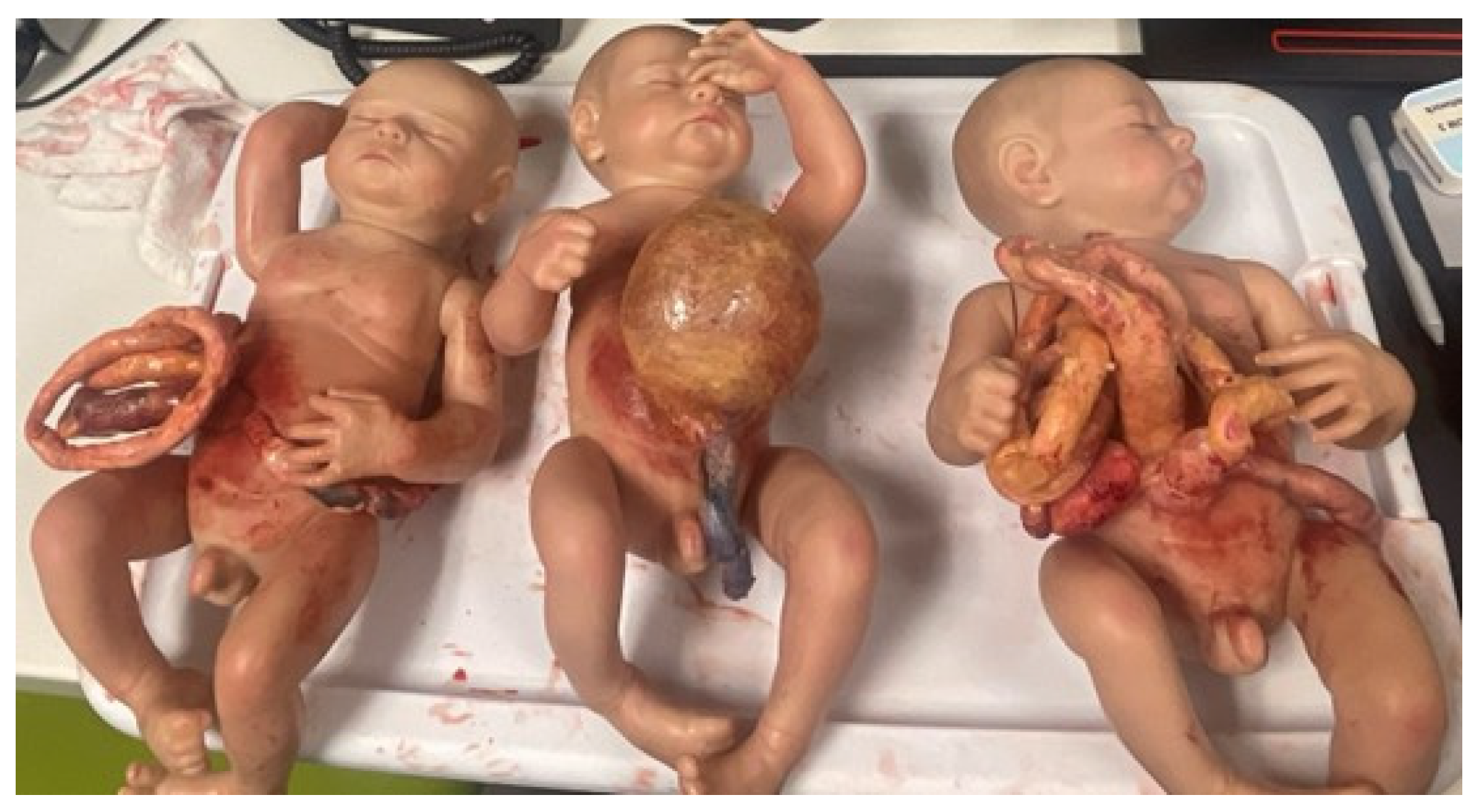 Children 11 00034 g001