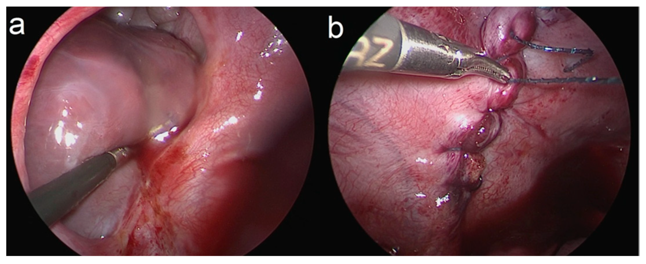 Children 11 00035 g002