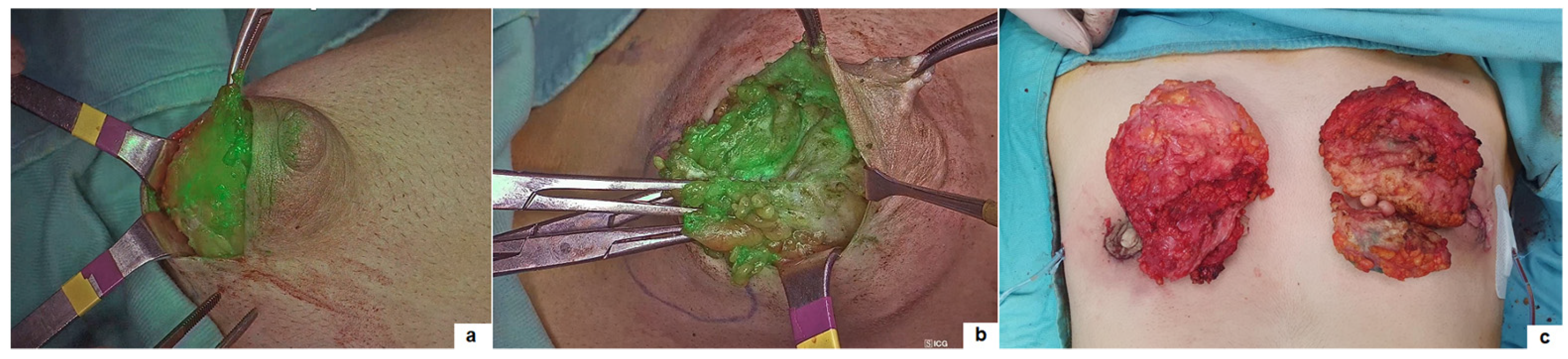 Children 11 00054 g003