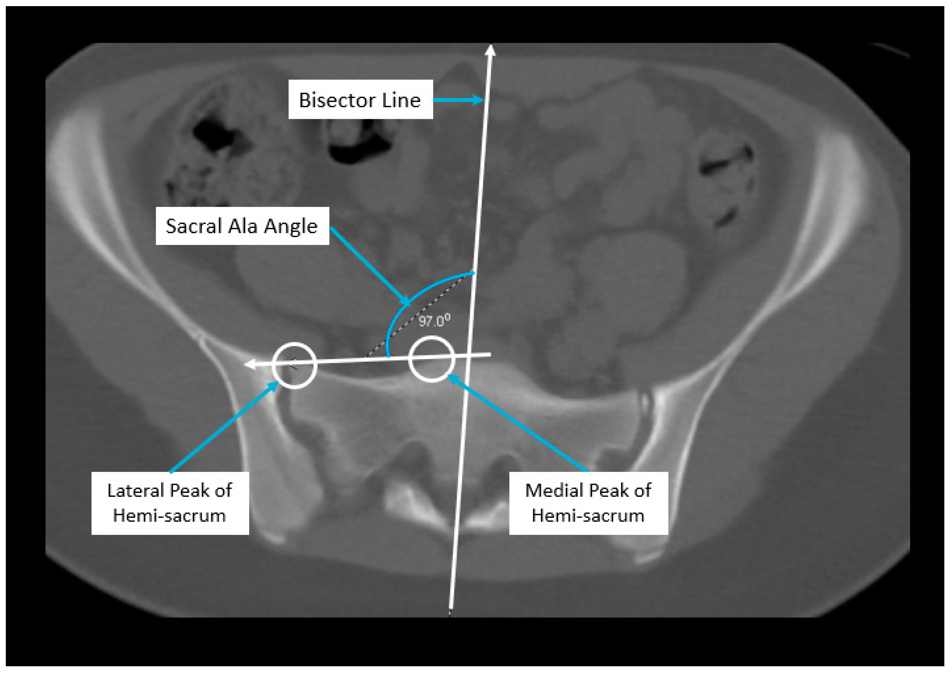 Children 11 00063 g002