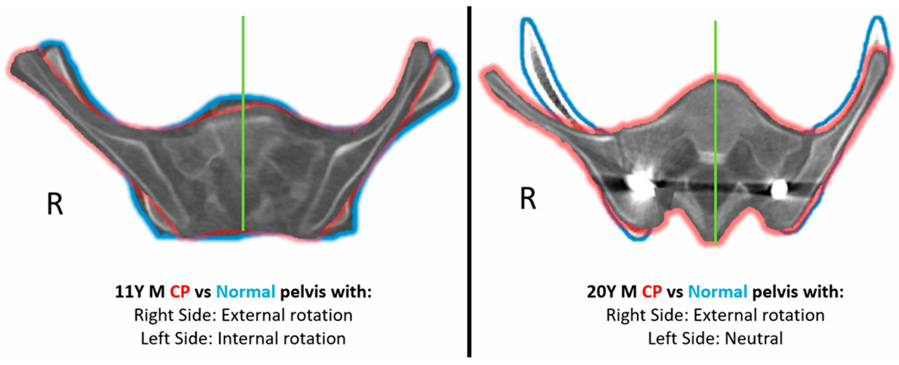 Children 11 00063 g003