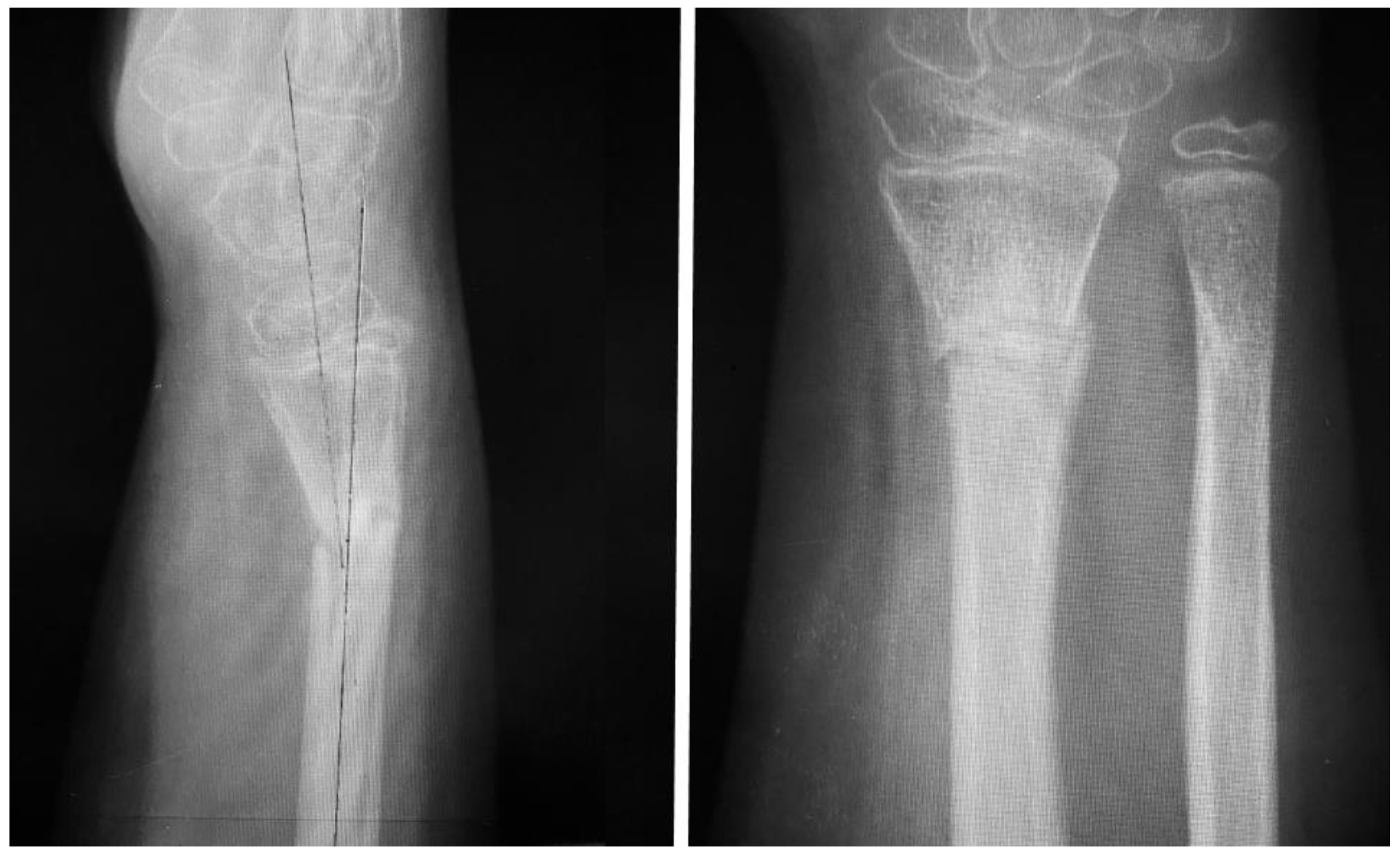 Children 11 00116 g003