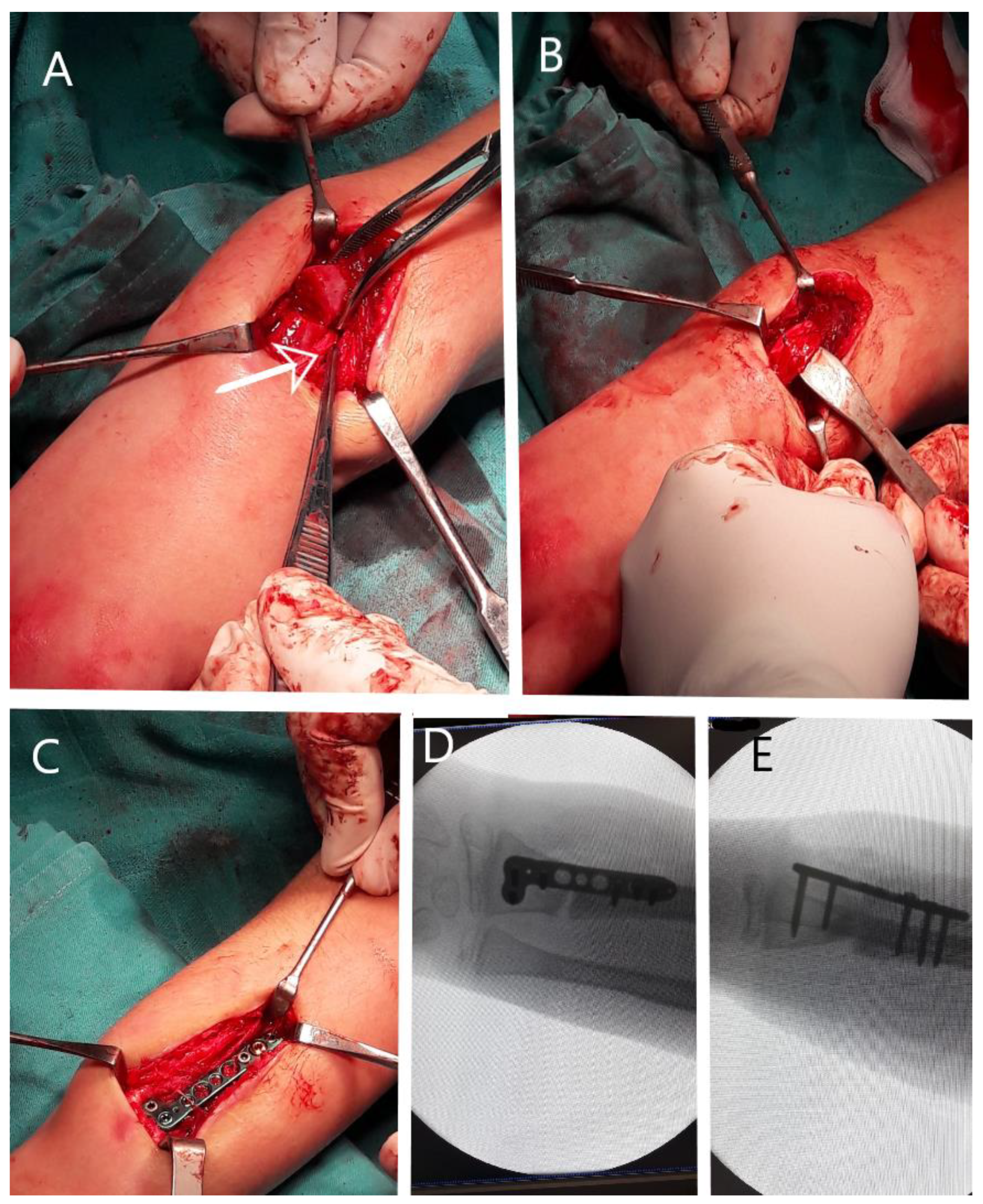 Children 11 00116 g005