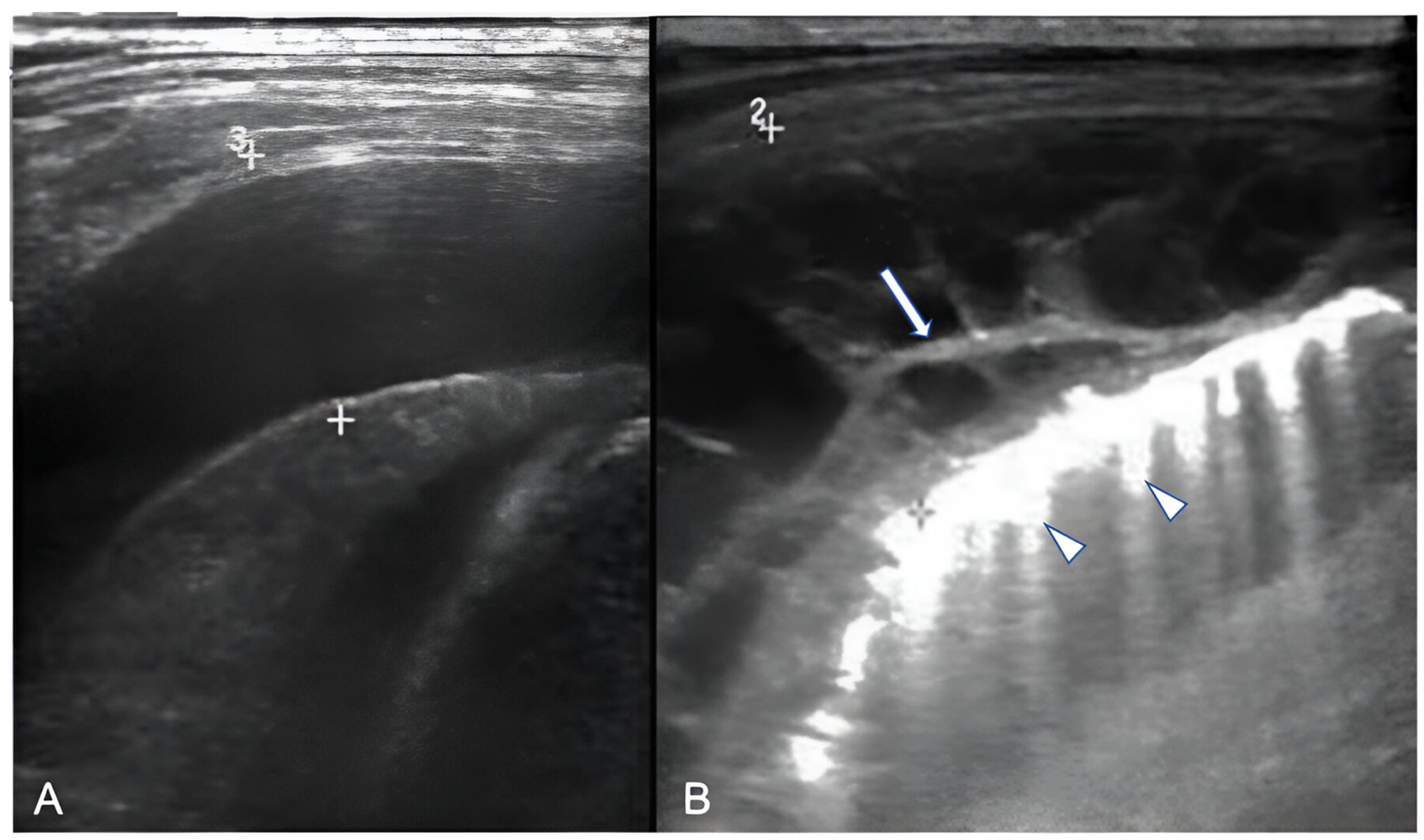 Children 11 00122 g003