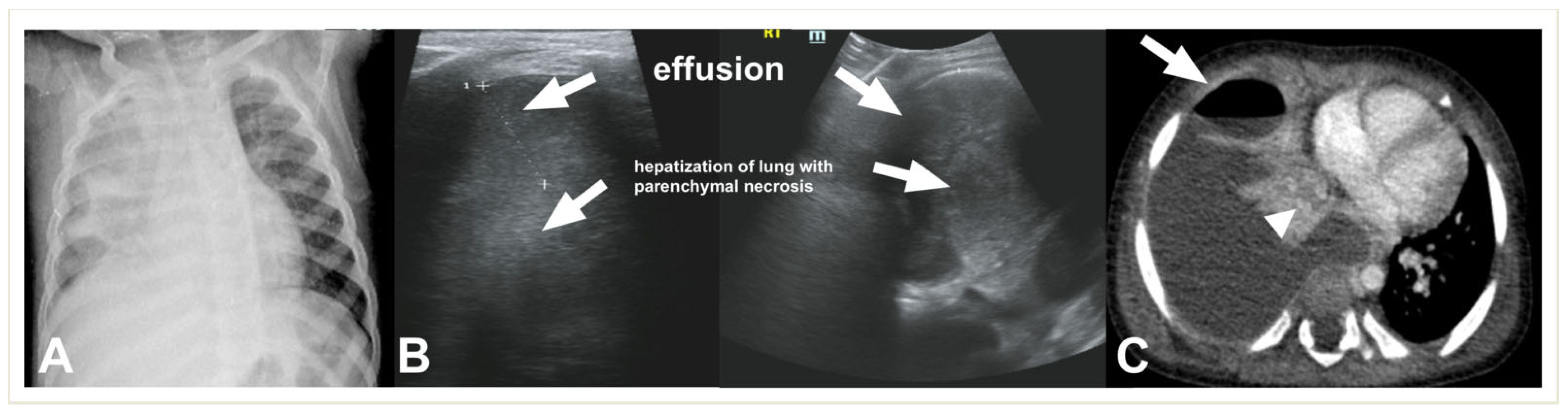 Children 11 00122 g008