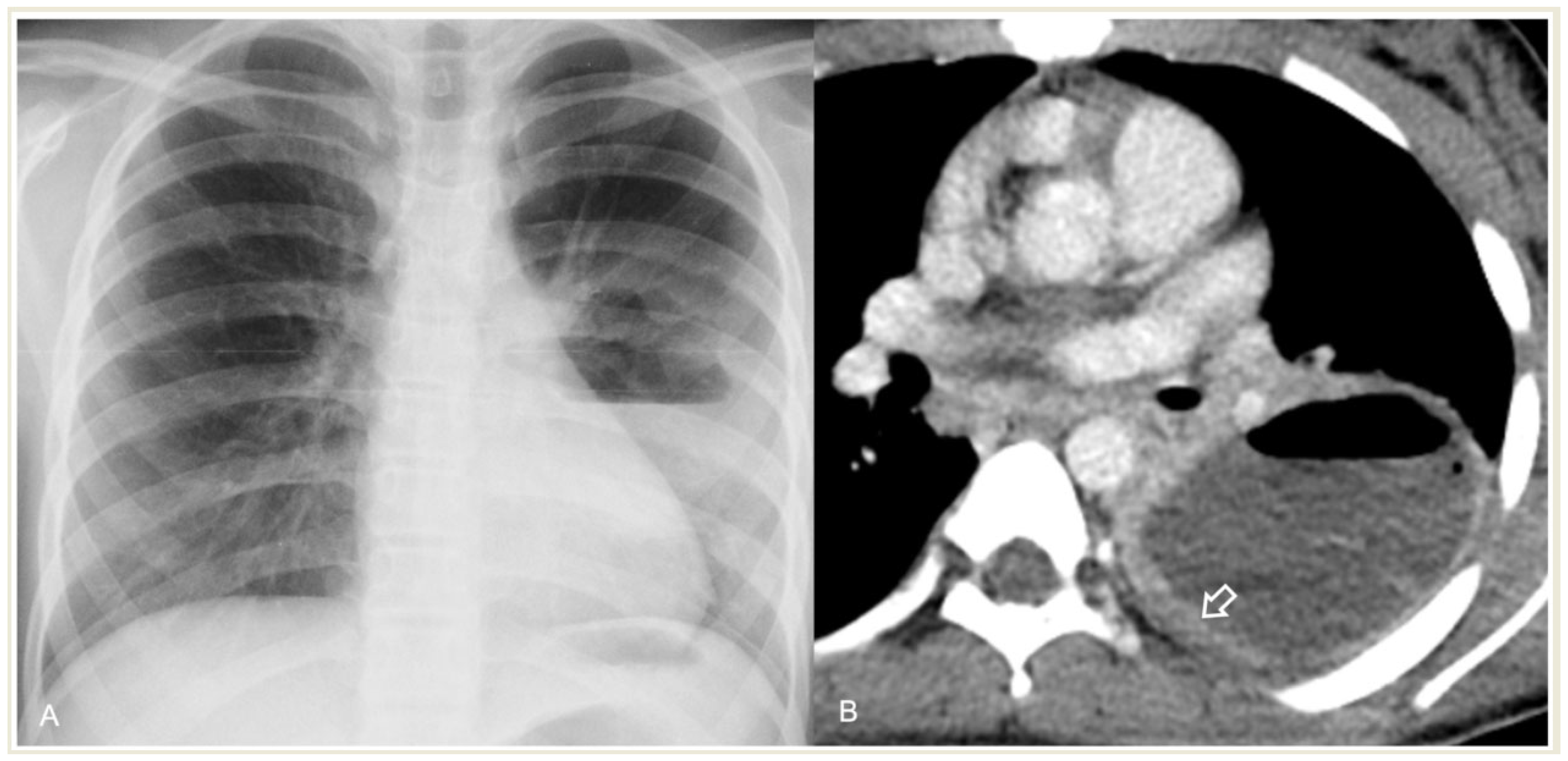 Children 11 00122 g011