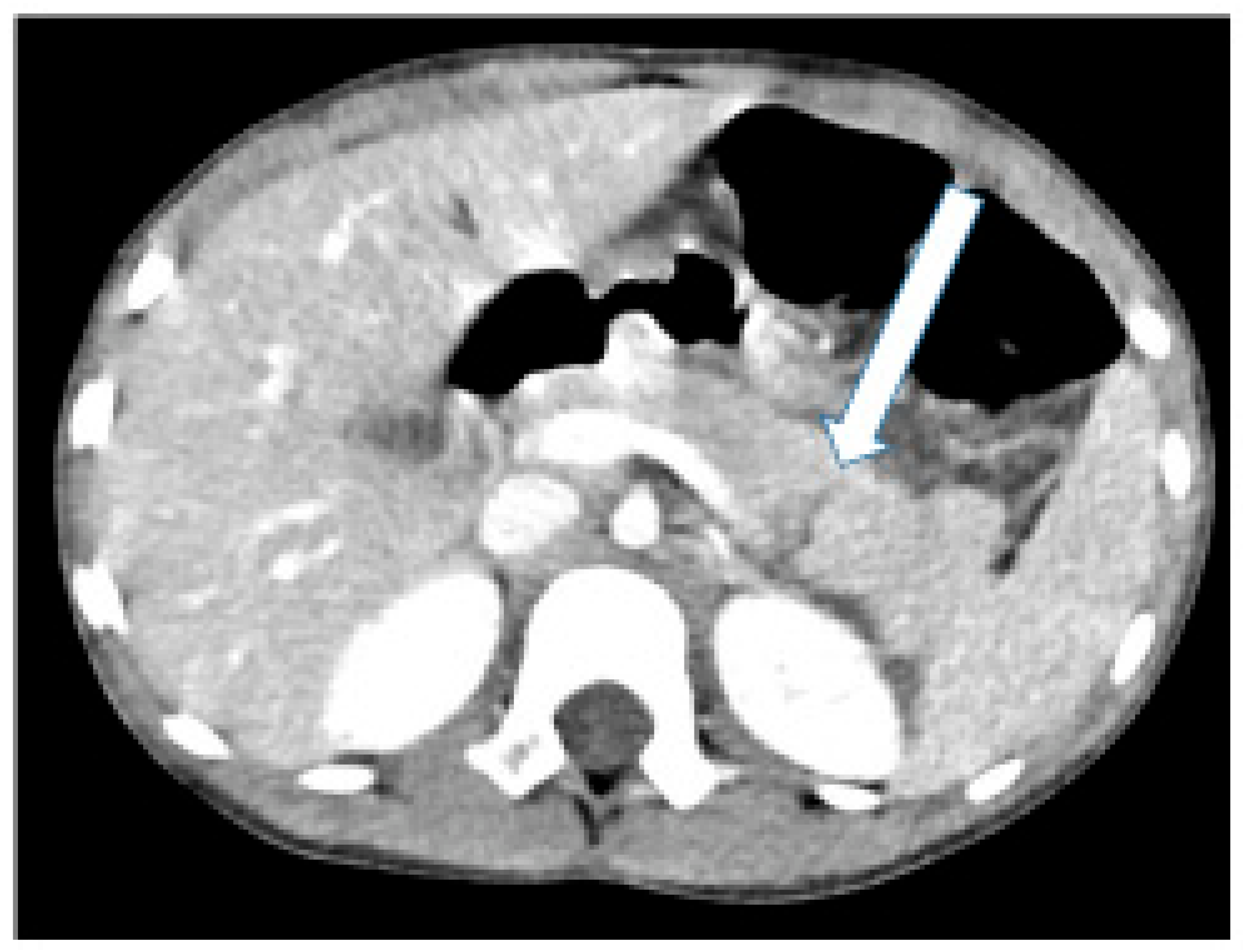 Children 11 00135 g001