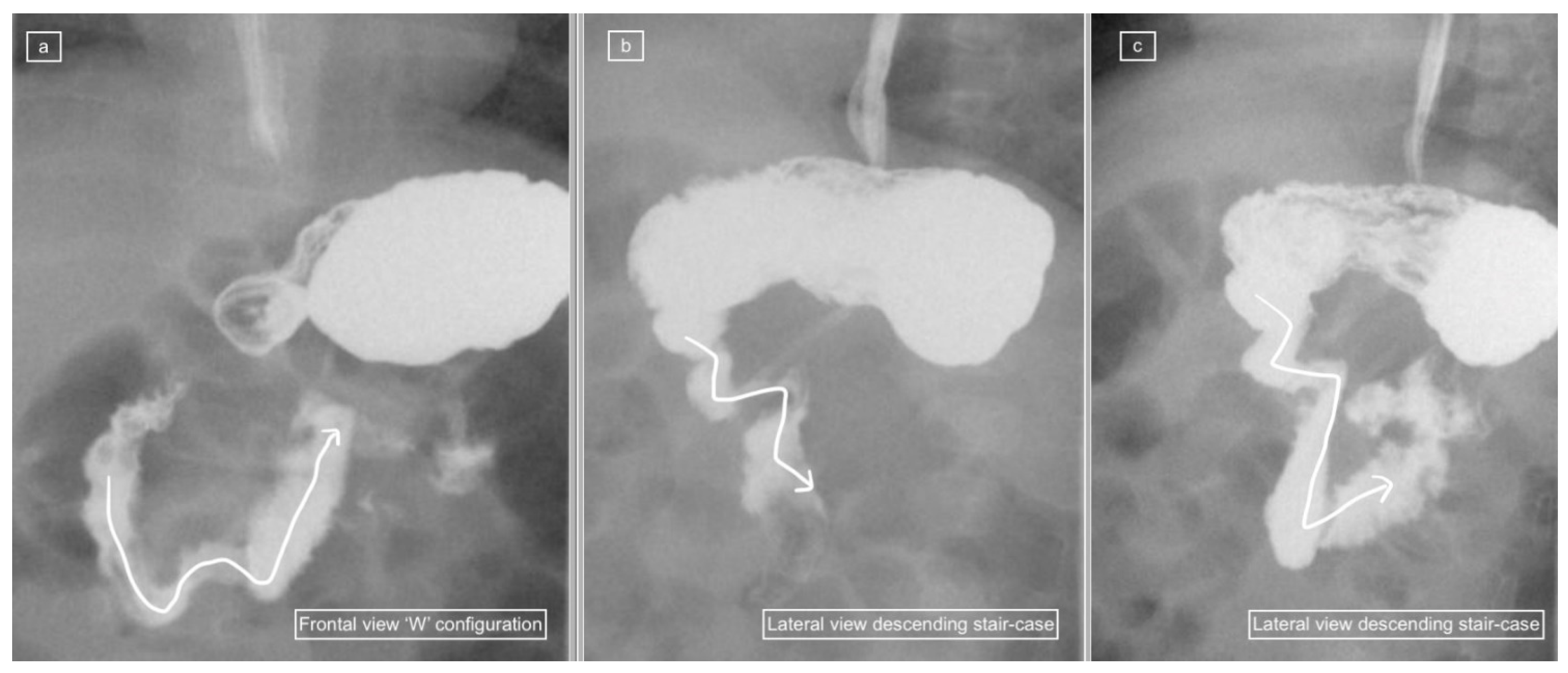 Children 11 00151 g002