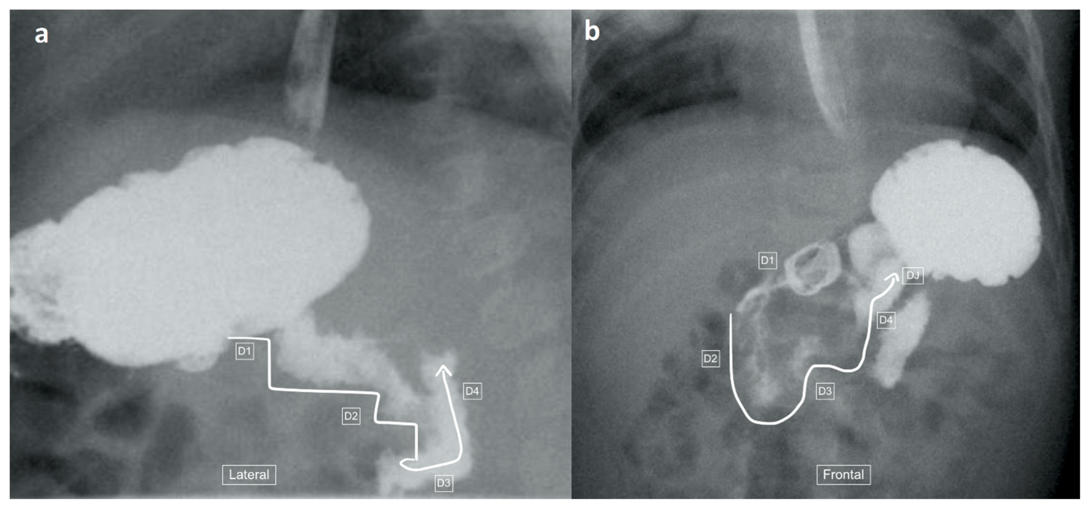 Children 11 00151 g004