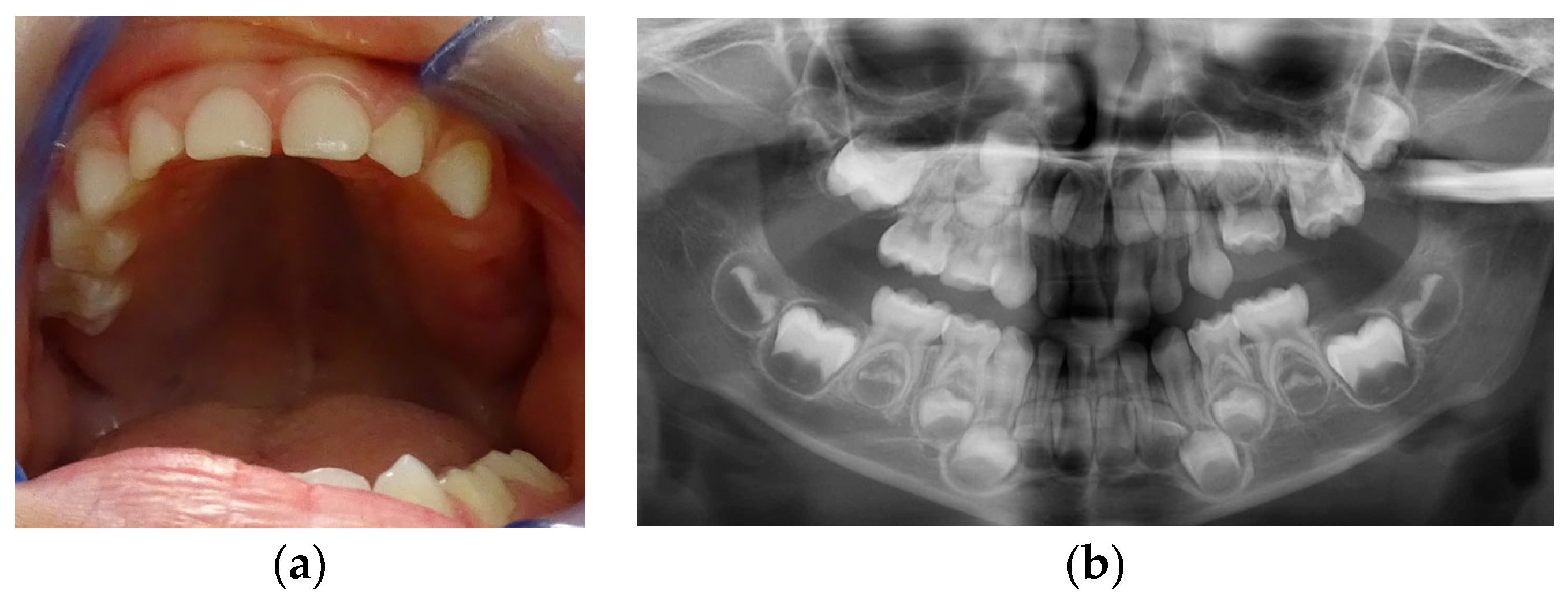 Children 11 00152 g001