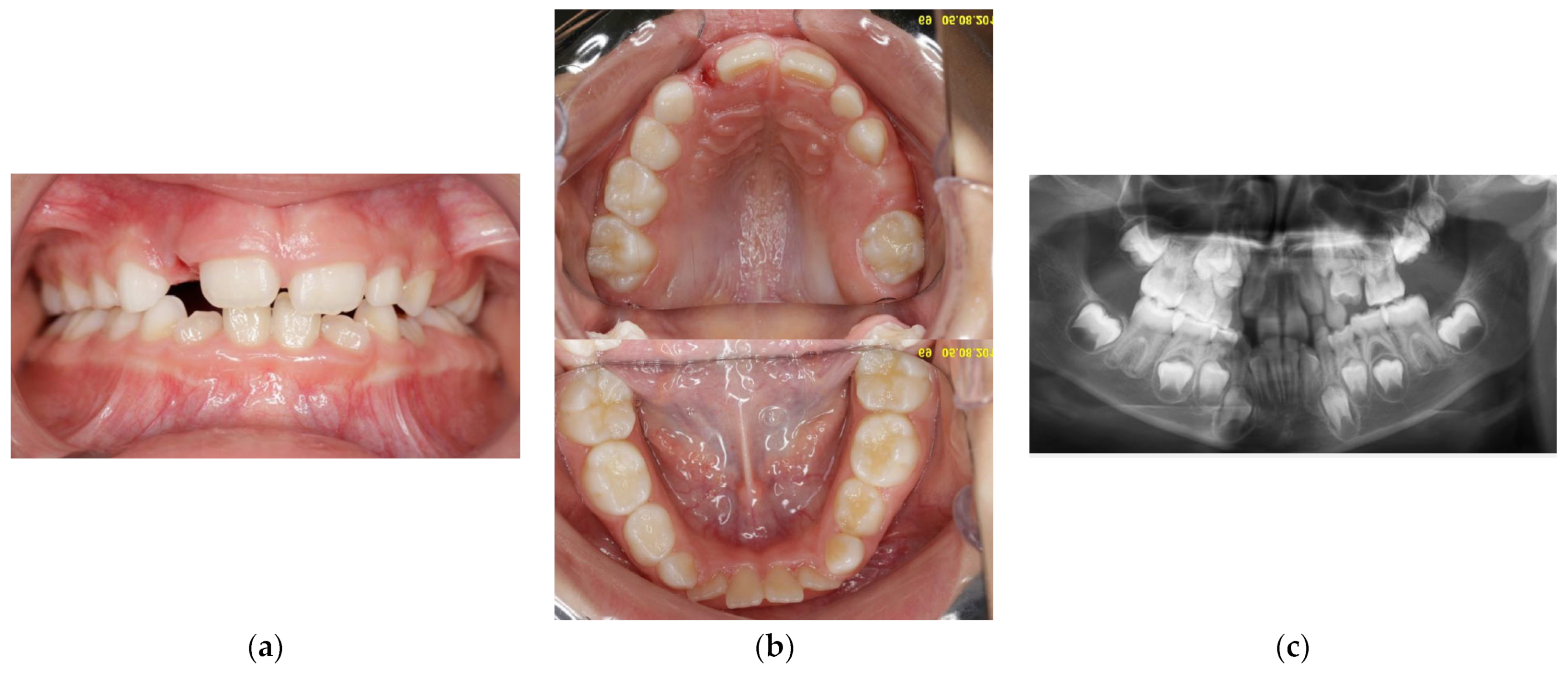 Children 11 00152 g003