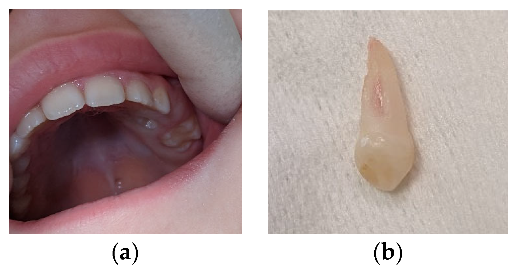 Children 11 00152 g005