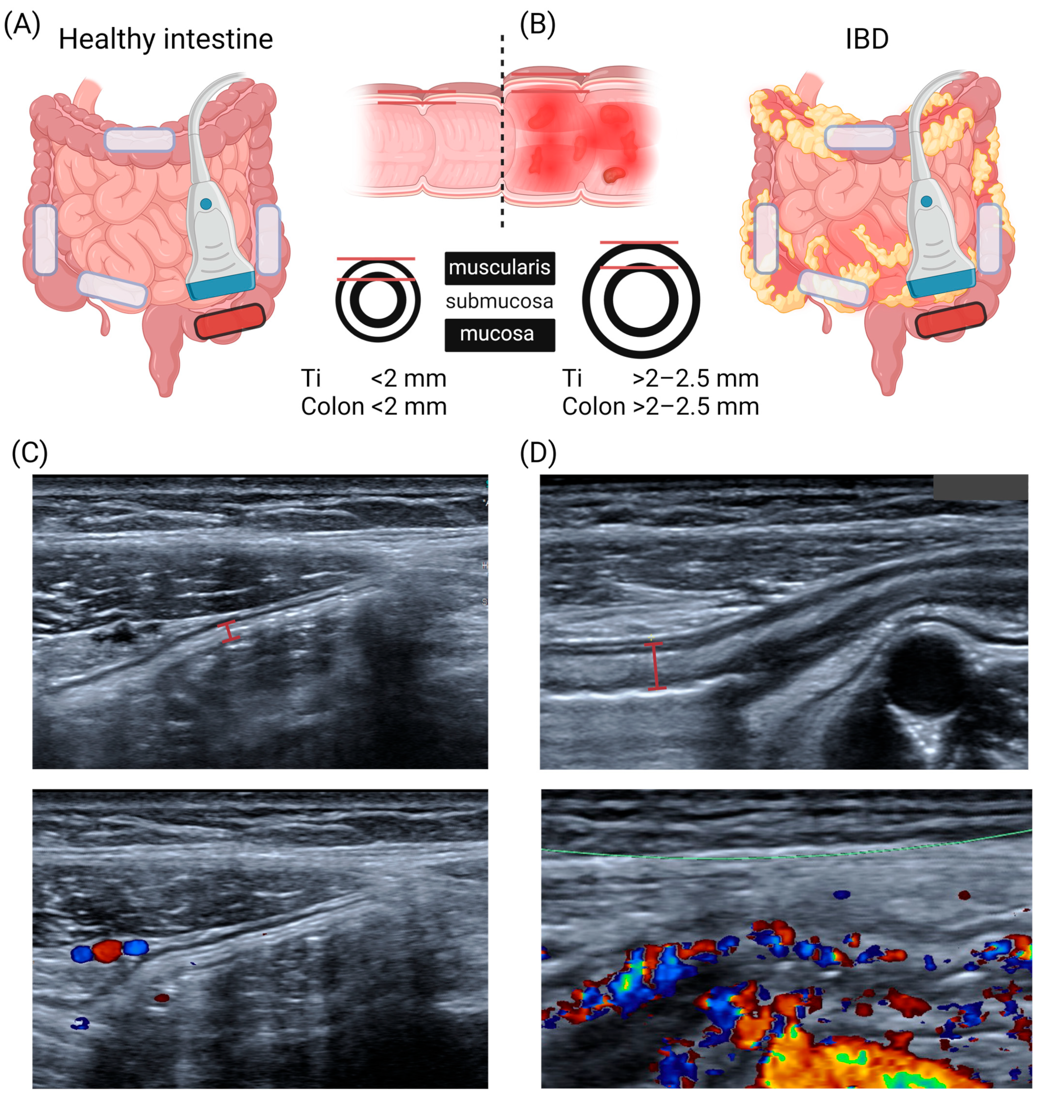 Children 11 00156 g001 Children 11 00156 g001