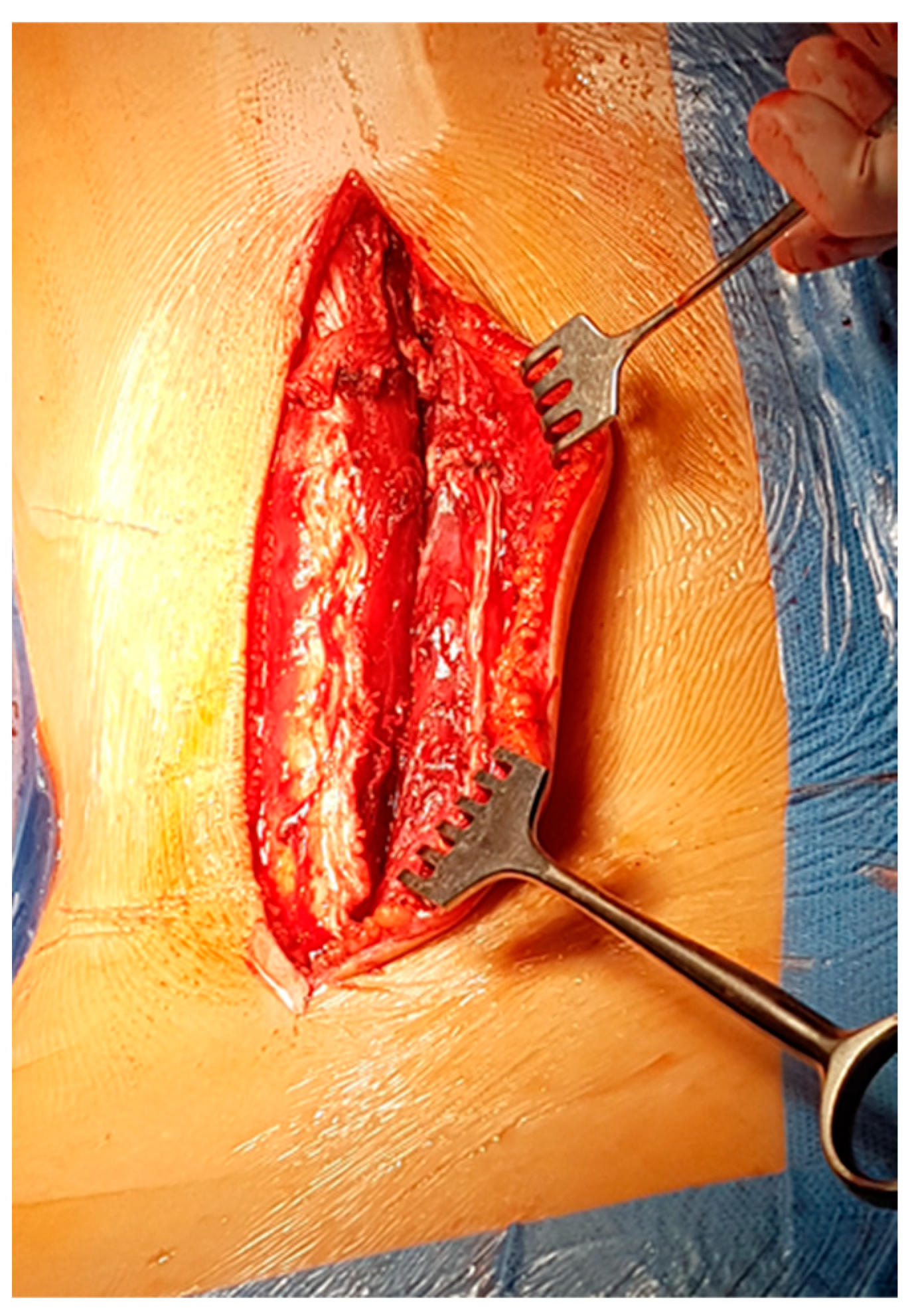 Children 11 00157 g001