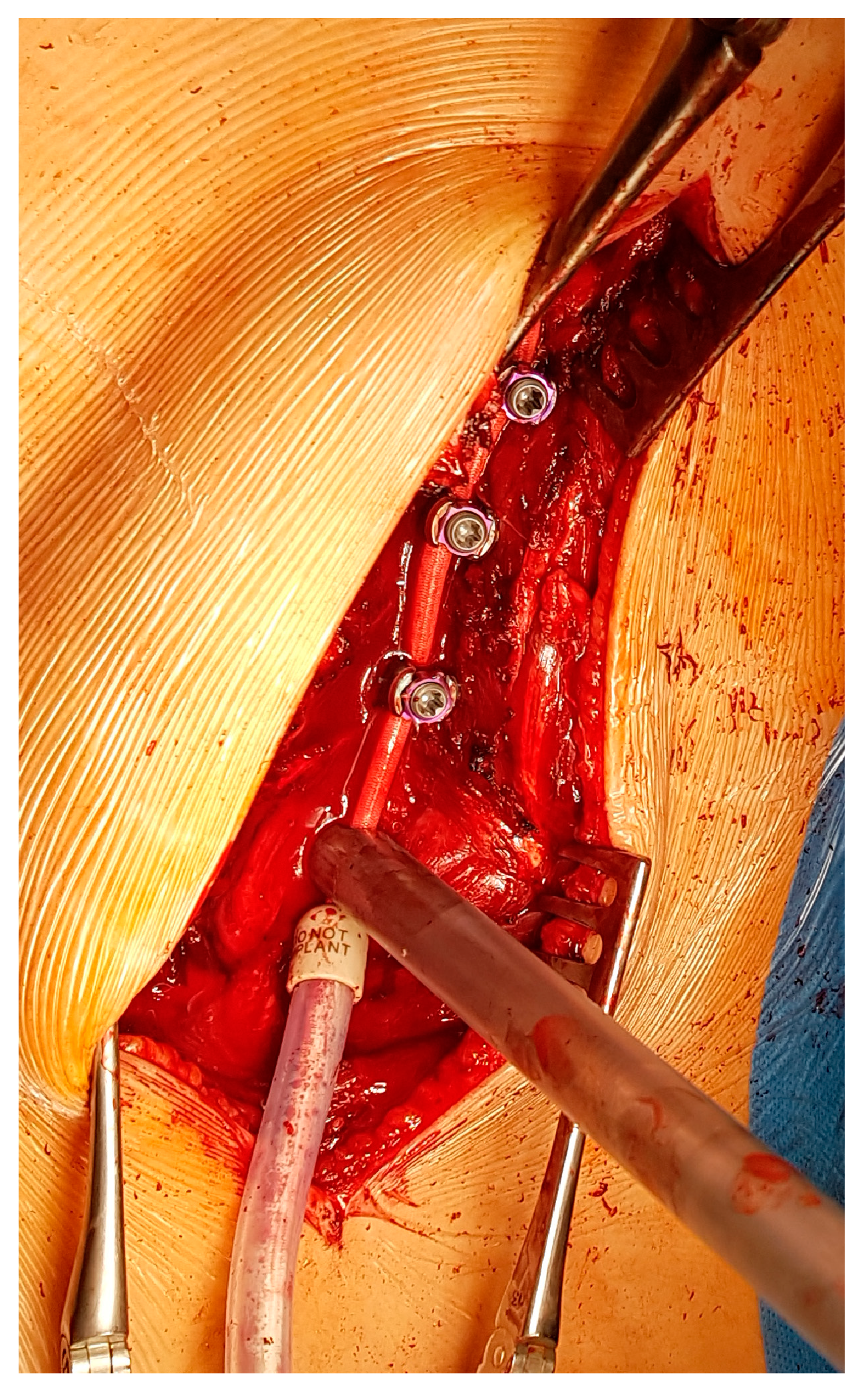 Children 11 00157 g006