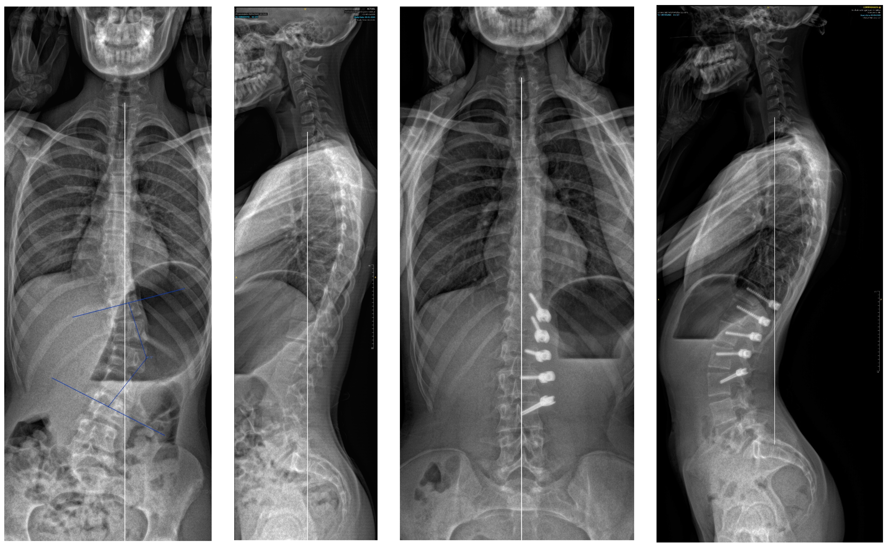 Children 11 00157 g007