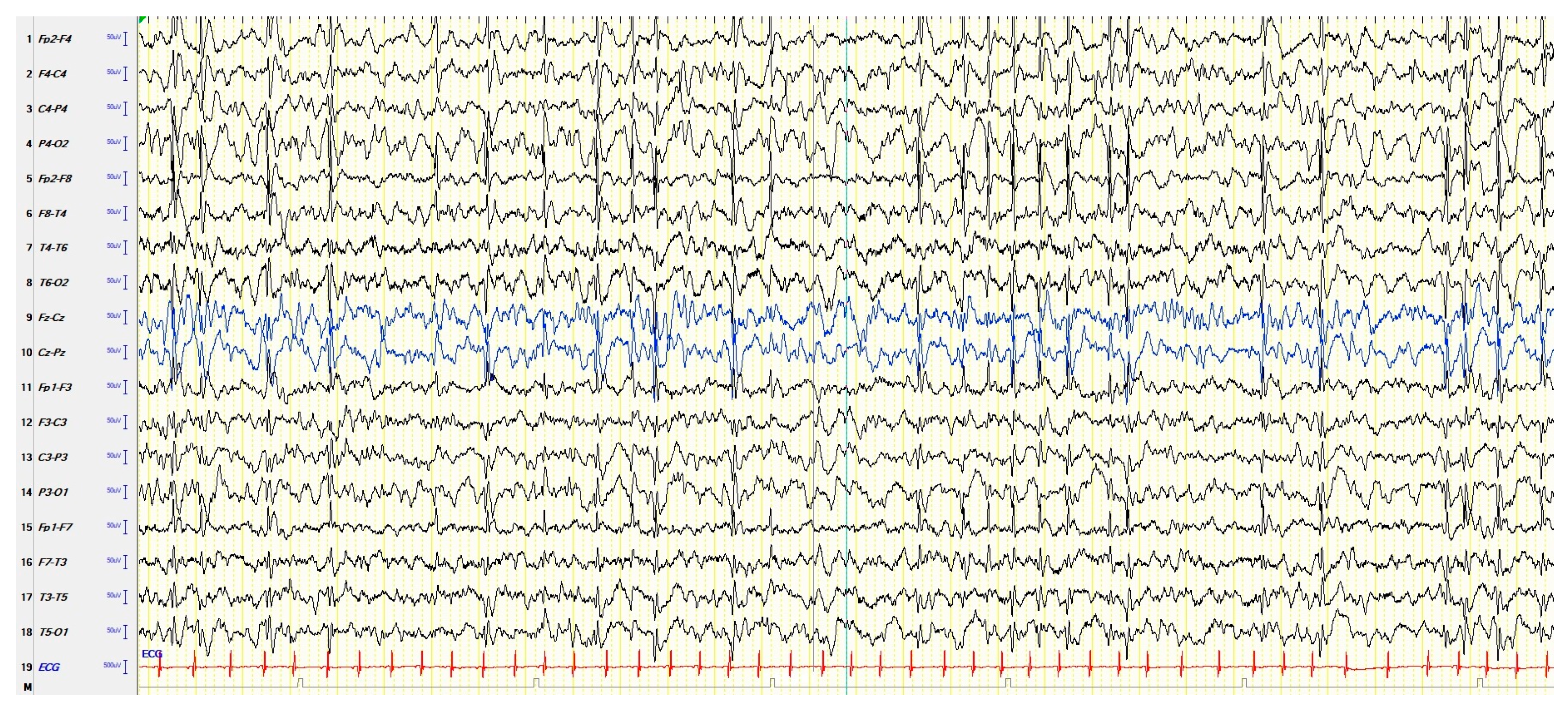 SHE'll SLEEP Years、Days、See The Light ZVdjGZ3hyvqFoS6xiHfHej-1920-80.jpg