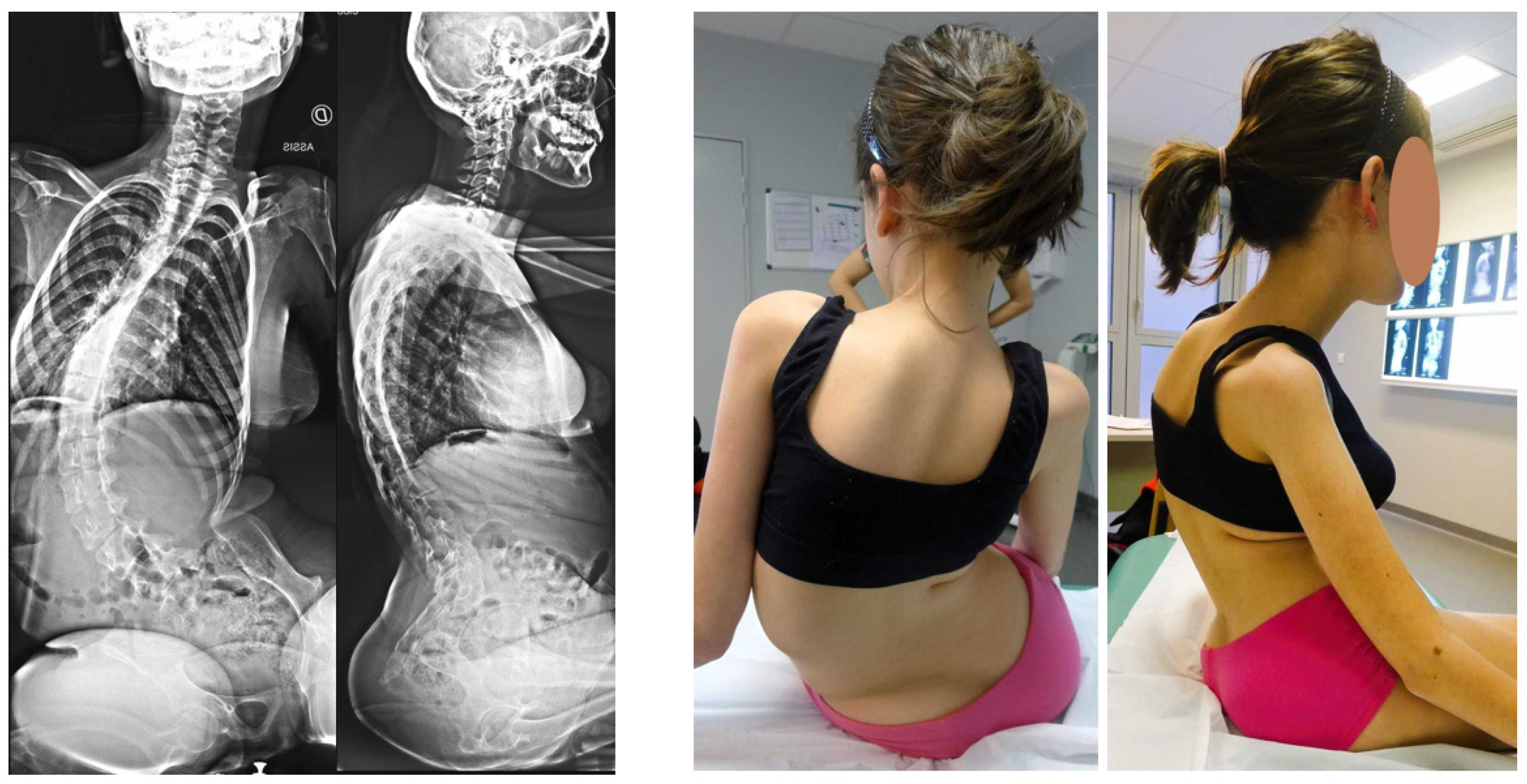 Children 11 00199 g002