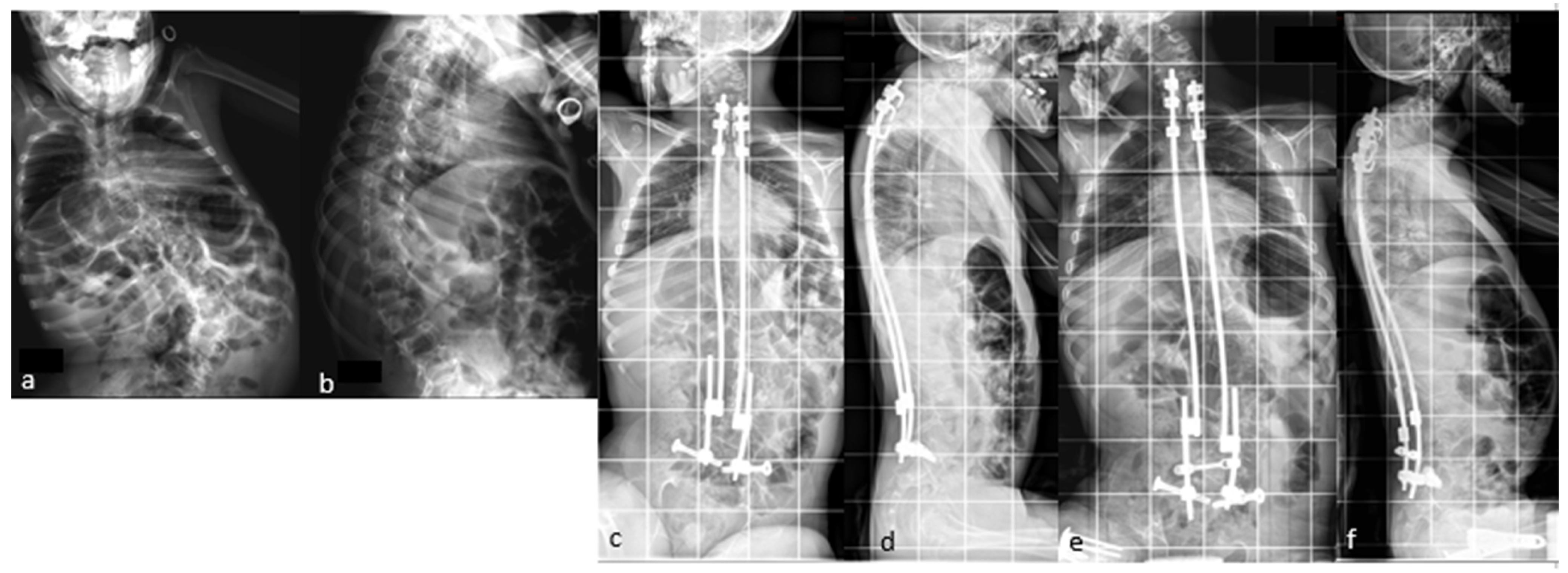 Children 11 00228 g004a