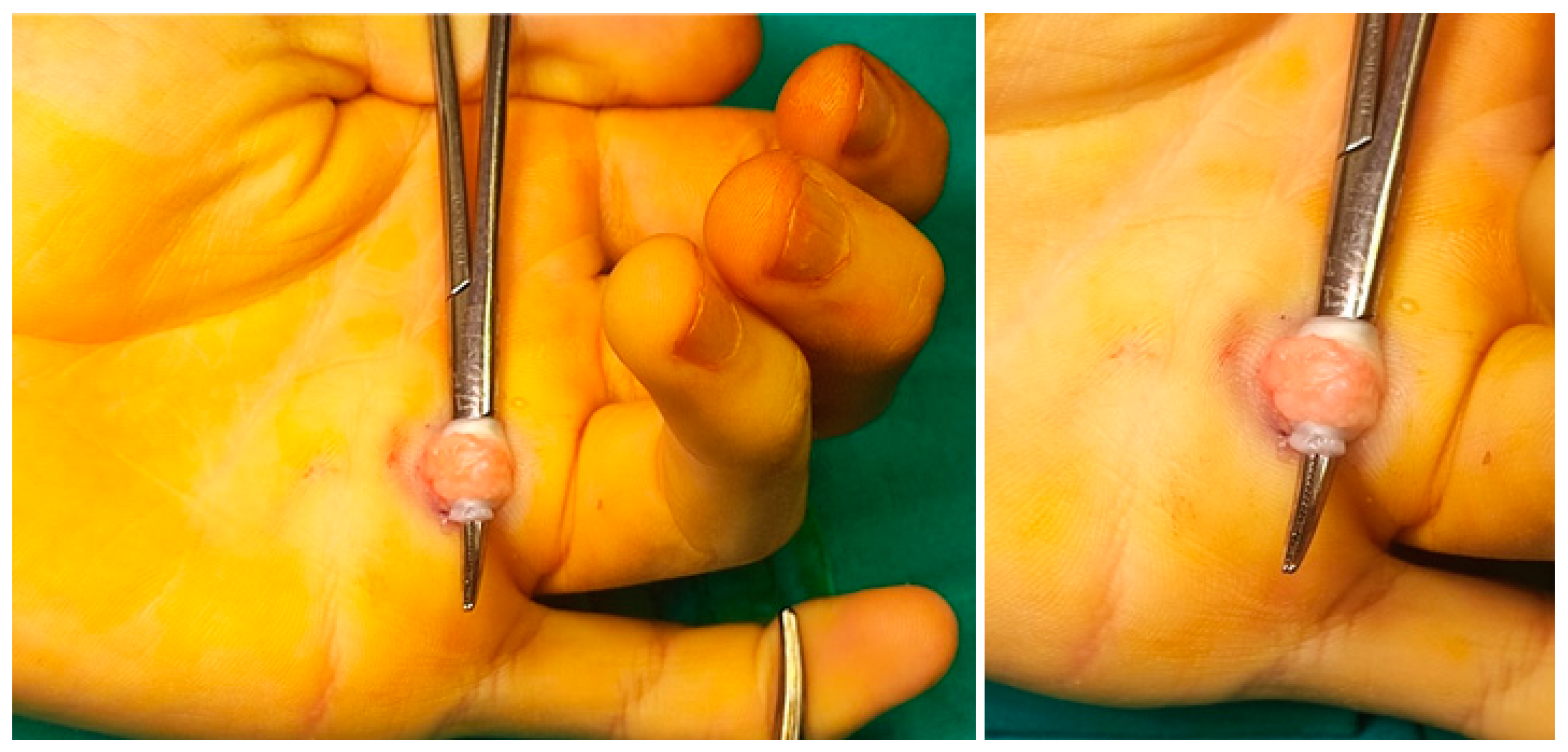 Children 11 00294 g004