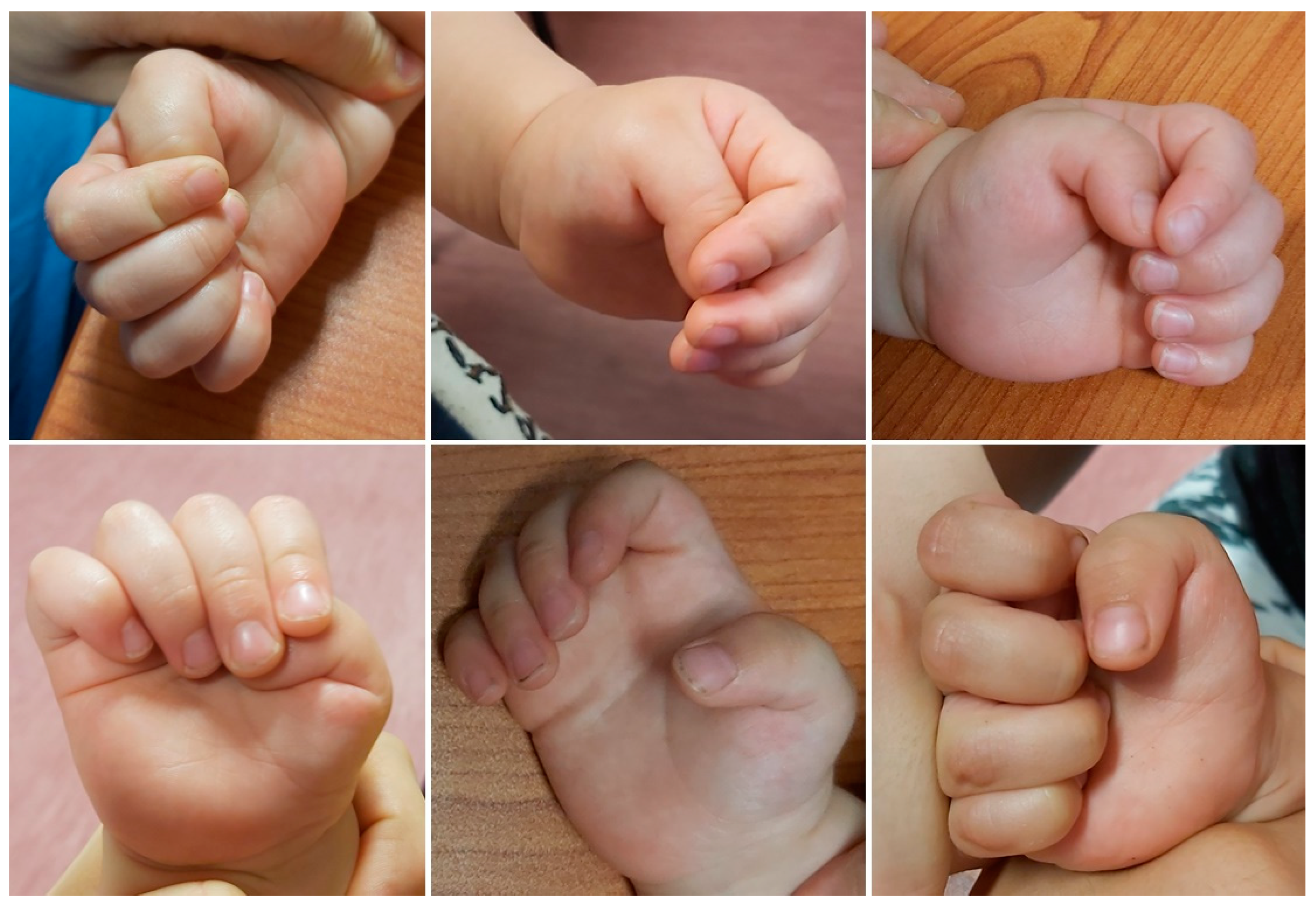 Children 11 00294 g005