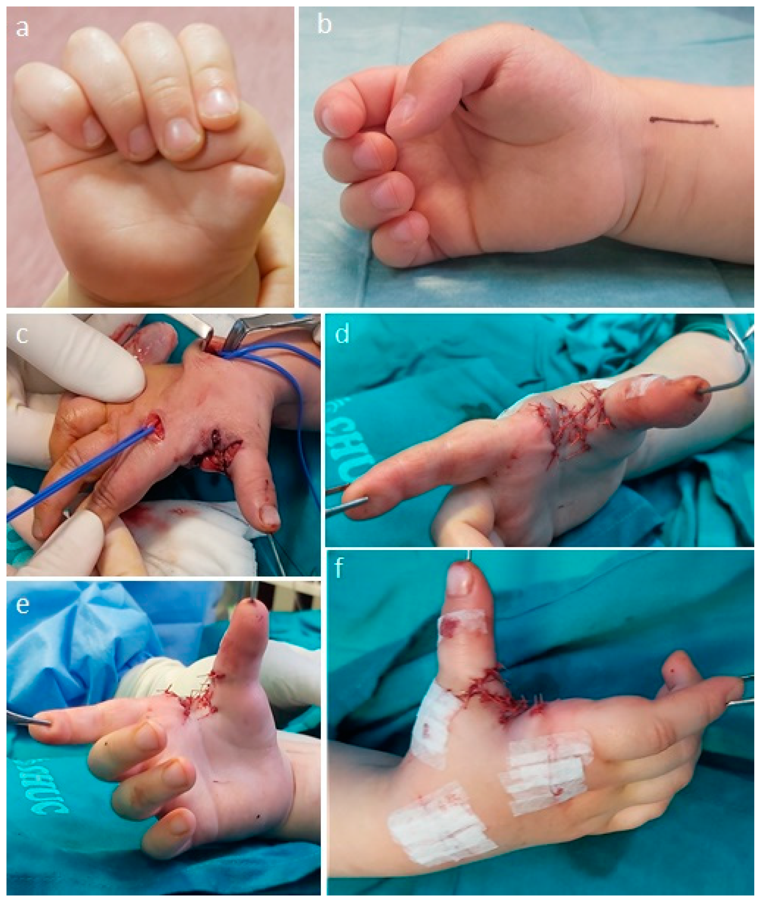 Children 11 00294 g006