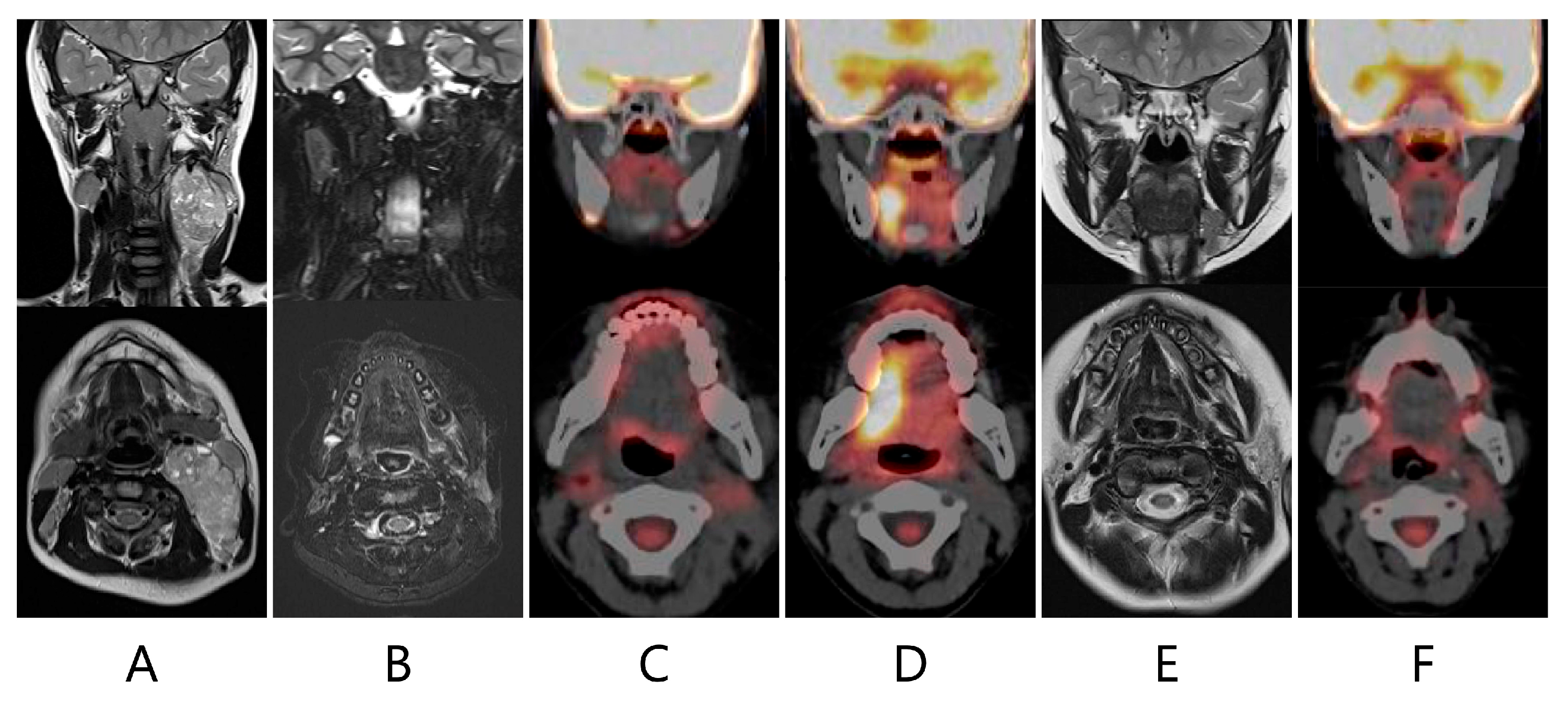 Children 11 00348 g002