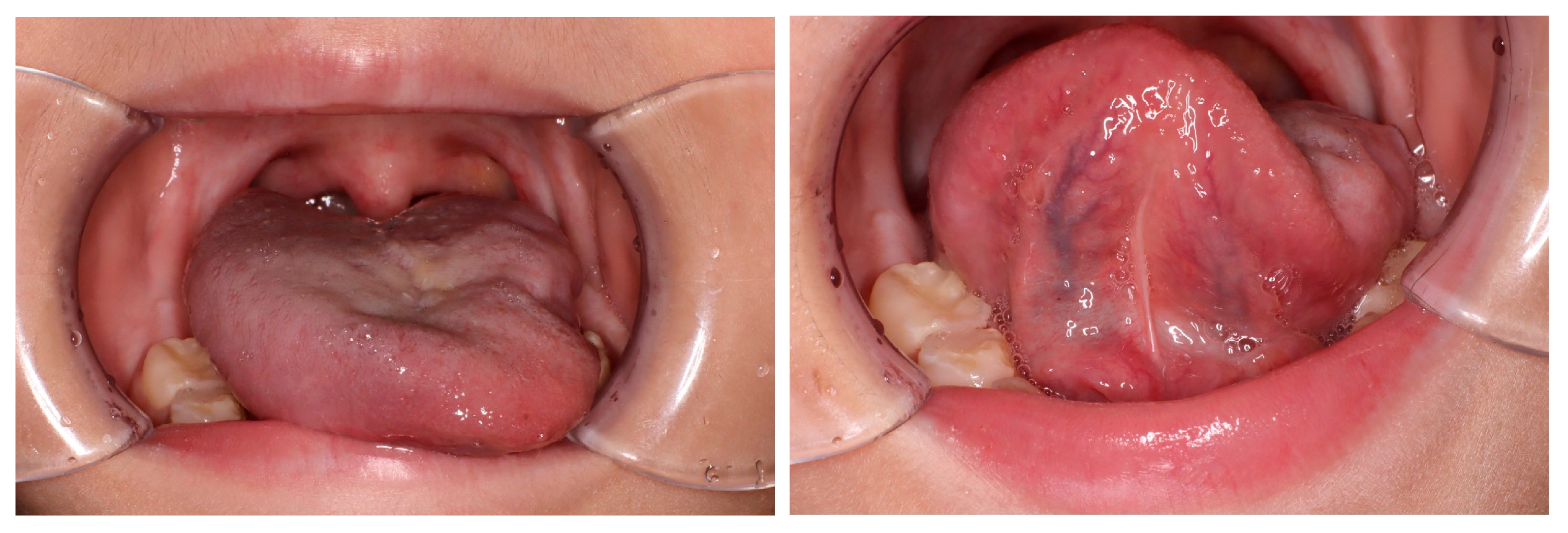 Children 11 00348 g003