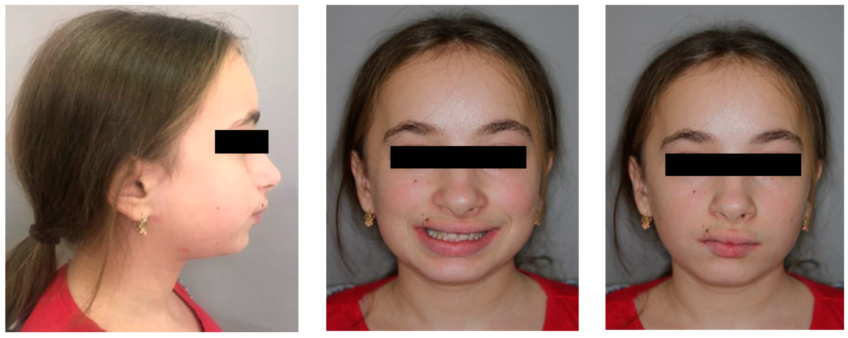 Children 11 00358 g001